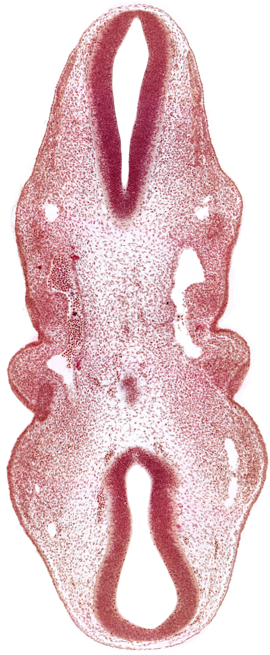 caudal edge(s) of rhombencephalon, dermatomyotome 2 (O-2) , dermatomyotome 3 (O-3) , dorsal aorta, primary head vein, primordium of trigeminal nerve (CN V)