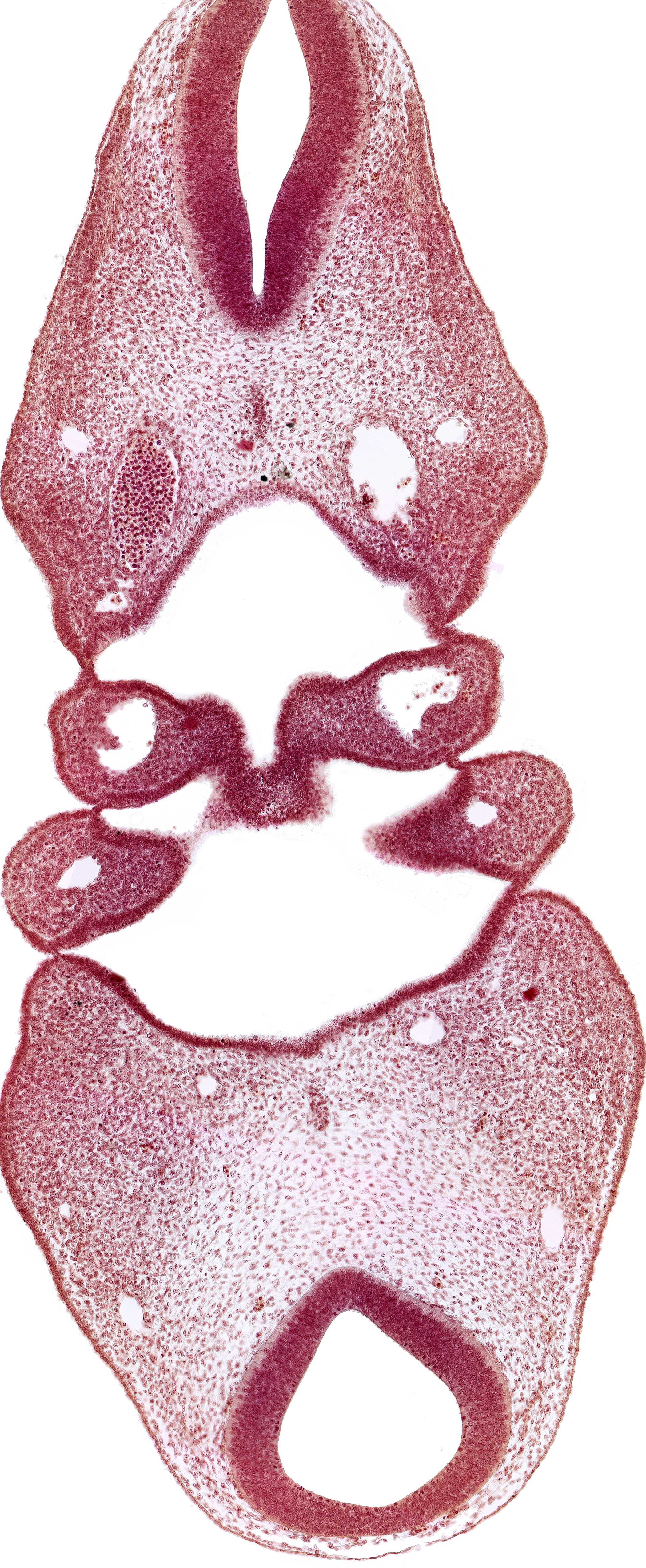 dermatomyotome 4 (O-4) , hypopharyngeal eminence of tongue, notochord, region of cervical flexure, region of mesencephalic (cephalic) flexure