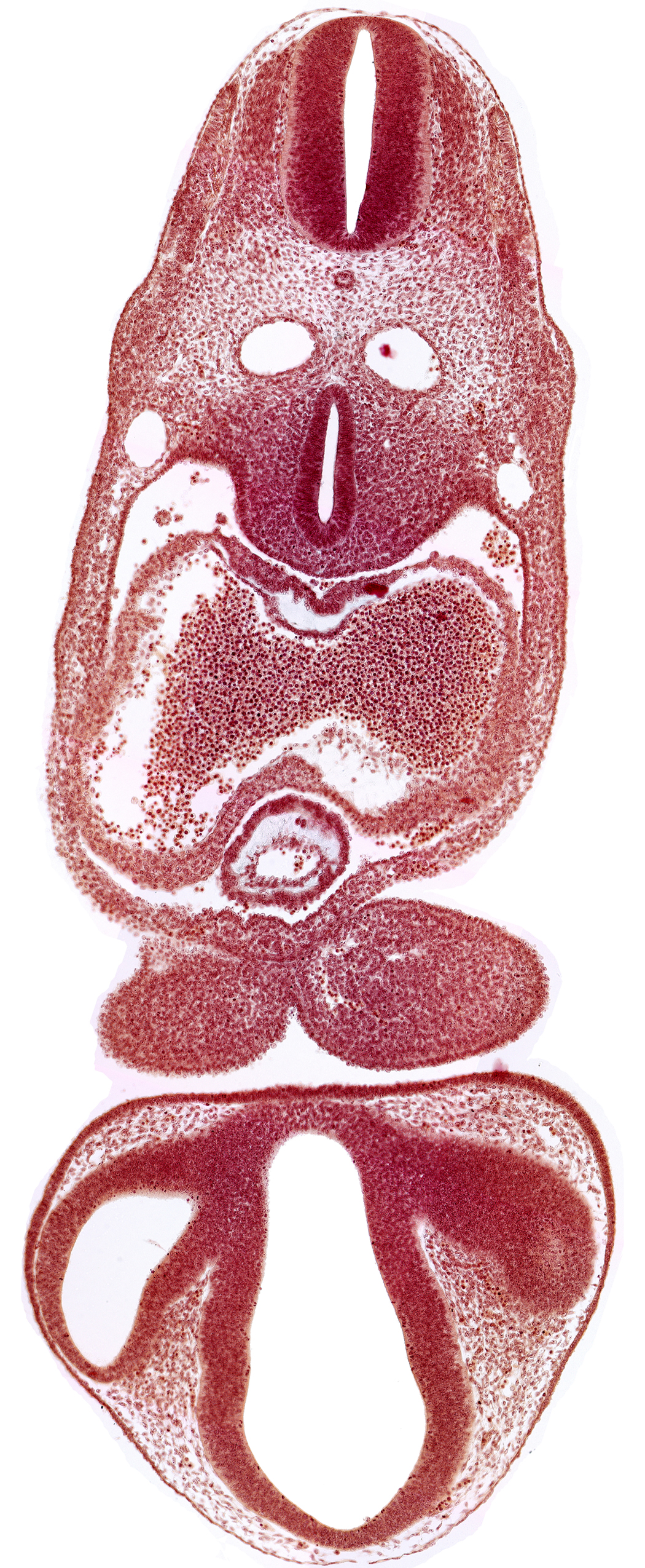 anterior cerebral plexus, chiasmatic part of diencephalon, dermatomyotome 6 (C-2), dorsal aorta, dorsal thalamus, endocardium, epicardial ridge, epithalamus, left atrium, mandibular prominence of pharyngeal arch 1, marginal layer of spinal cord, median mandibular groove, notochord, optic stalk (CN II), pericardial cavity, precardinal vein, prosencoel (third ventricle), right atrium, tracheo-esophageal tube, truncus arteriosus, ventral thalamus