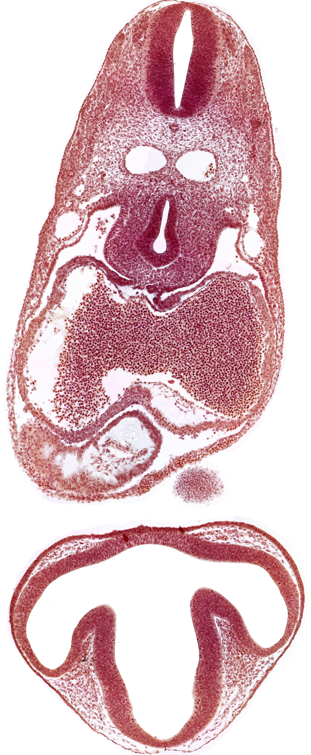 C-2 spinal ganglion primordium, caudal edge of mandibular prominence of pharyngeal arch 1, communication of prosencoel (third ventricle) with optic vesicle, dermatomyotome 6 (C-2), dorsal aorta, dorsal thalamus, epithalamus, left atrium, mesocardium, notochord, optic vesicle, pericardial cavity, precardinal vein, prosencoel (third ventricle), right atrial wall, right ventricle, tracheo-esophageal tube, ventral thalamus