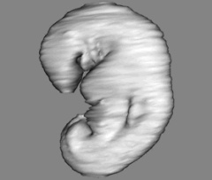 Embryo