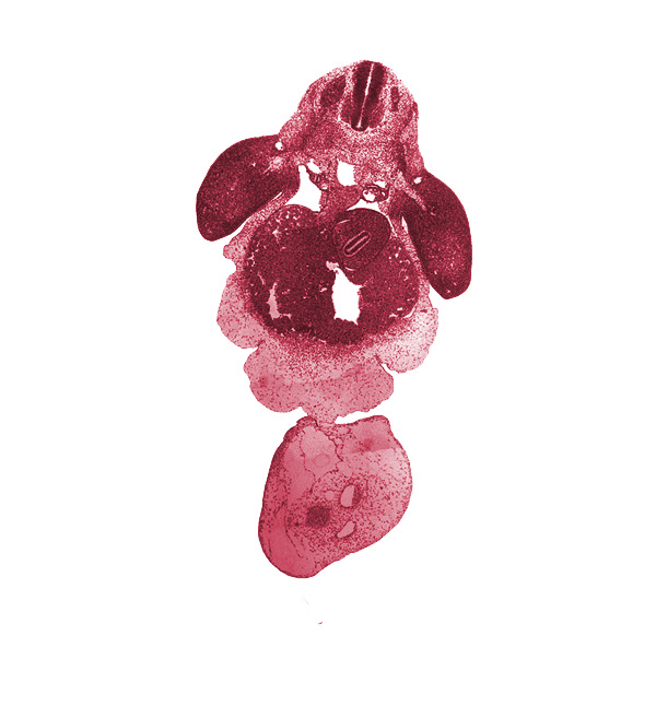 C-7 spinal ganglion, allantois, aorta, apical ectodermal ridge, cephalic recess of lesser sac (omental bursa), common umbilical vein, dermatome, dorsal mesogastrium, ductus venosus, left lobe of liver, left umbilical artery, myotome, neural arch primordium, origin of dorsal intersegmental artery, peritoneal cavity, postcardinal vein, right umbilical artery, sclerotome, septum transversum, stomach, umbilical coelom, umbilical cord