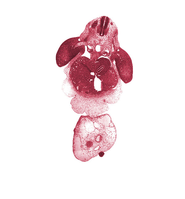 aorta, brachial plexus, caudal part of pericardial sac, cephalic edge of C-8 spinal ganglion, common umbilical vein, dermatome, dorsal mesogastrium, ductus venosus, gall bladder primordium, junction of mesonephric duct and tubule, left lobe of liver, left umbilical artery, lesser  sac, myotome, neural tube, post anal gut, postcardinal vein, right lobe of liver, right umbilical artery, septum transversum, stomach, tip of caudal eminence, umbilical coelom, umbilical cord, upper limb