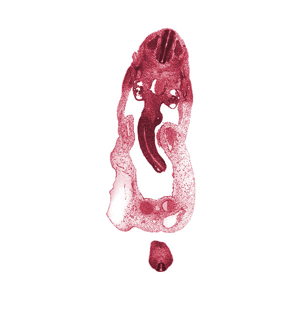 S-4 spinal ganglion, T-2 spinal ganglion, allantois, anal tubercle, cloacal membrane, dermatomyotome, dorsal mesentery, involuting right umbilical vein, left umbilical artery, left umbilical vein, mammary crest, mesonephric artery, mesonephric duct, midgut loop, neural tube, notochord, peritoneal cavity, postcardinal vein, right umbilical artery, superior mesenteric artery, umbilical coelom