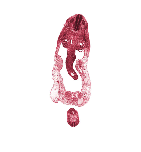 S-3 / S-4 interganglion region, T-2 spinal ganglion, alar plate(s), allantois, aorta, basal plate, cloaca, cloacal membrane, dermatomyotome, dorsal mesentery, floor plate, gonadal ridge, left umbilical artery, left umbilical vein, mammary crest, mesonephros, midgut loop, myotome, neural tube, notochord, omphalomesenteric (superior mesenteric) vein, peritoneal cavity, right umbilical artery, roof plate, sulcus limitans, superior mesenteric artery, surface epithelium, umbilical coelom