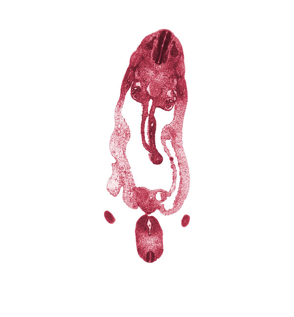 T-3 spinal ganglion, aorta, cephalic edge of lower limb, cloaca, cloacal membrane, dermatomyotome, dorsal mesentery, genital tubercle, glomerulus, gonadal epithelium, left umbilical vein, mammary crest, mesonephros, midgut loop, myotome, neural tube, notochord, omphalomesenteric (superior mesenteric) vein, peritoneal cavity, postcardinal vein, sclerotome, superior mesenteric artery, umbilical coelom