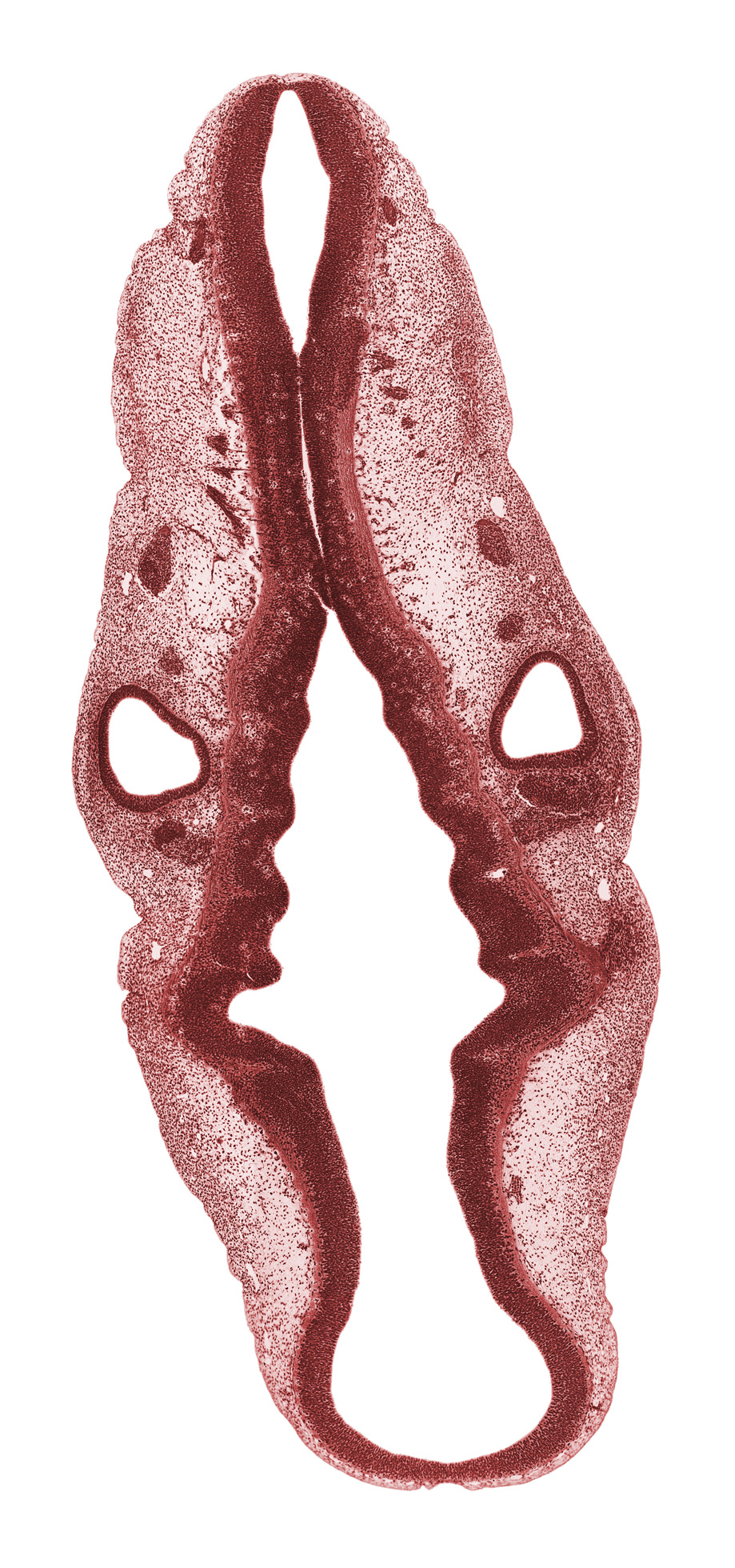 anterior dural venous plexus, cephalic edge of trigeminal ganglion (CN V), geniculate and vestibulocochlear ganglia (CN VII and CN VIII), mesencephalon (M2), mesencoel (cerebral aqueduct), metencephalon, middle dural venous plexus, myelencephalon (rhombomere D), posterior dural venous plexus, rhombencoel (fourth ventricle), rhombomere 1, rhombomere 2, rhombomere 3, rhombomere 5, rhombomere 6, root of hypoglossal nerve (CN XII), spinal accessory nerve (CN XI), superior ganglion of glossopharyngeal nerve (CN IX), superior ganglion of vagus nerve (CN X), transverse rhombencephalic sulcus