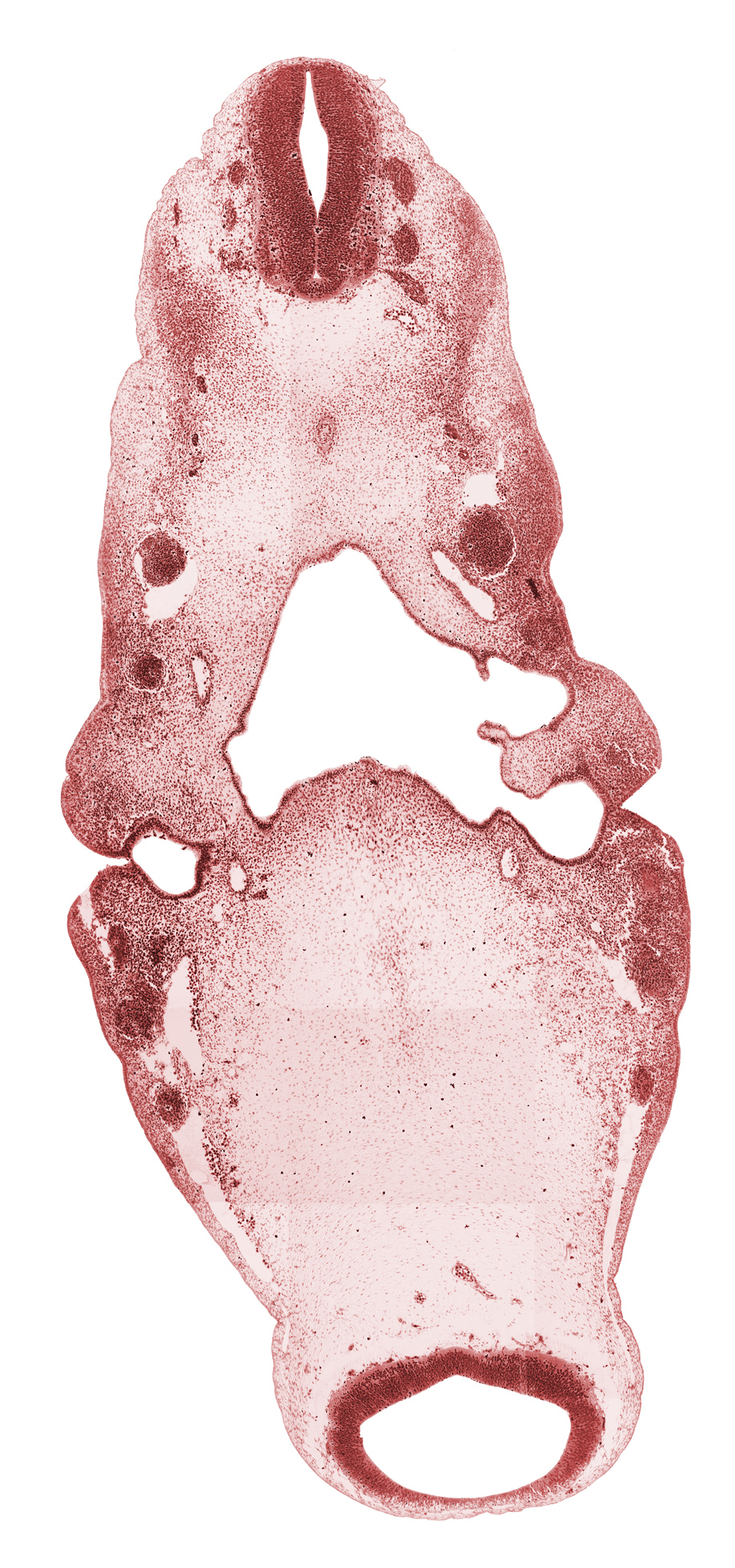 caudal edge of C-1 spinal ganglion, dorsal aorta, hypoglossal nerve (CN XII), inferior ganglion of glossopharyngeal nerve (CN IX), inferior ganglion of vagus nerve (CN X), internal carotid artery, junction of precardinal and primary head veins, maxillary nerve (CN V₂), mesencephalon (M1), mesencoel (cerebral aqueduct), neural canal, notochord, ophthalmic nerve (CN V₁), pharyngeal arch 1, pharyngeal arch 2, pharyngeal pouch 1, pontine flexure region, posterior cerebral artery, primary maxillary vein, spinal accessory nerve (CN XI), stem of anterior dural venous plexus