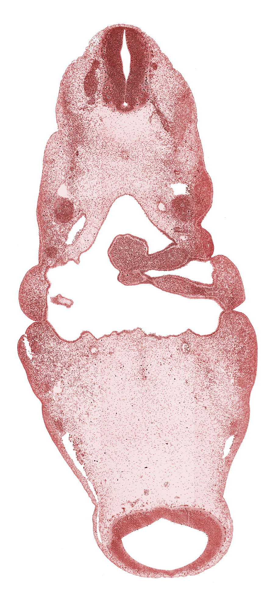 C-1 spinal nerve, cephalic part of notochord, dorsal aorta, hypopharyngeal eminence of tongue, inferior ganglion of glossopharyngeal nerve (CN IX), inferior ganglion of vagus nerve (CN X), internal carotid artery, maxillary nerve (CN V₂), mesencoel (cerebral aqueduct), neural arch primordium, notochord, ophthalmic nerve (CN V₁), pharyngeal arch 2, pharyngeal arch 3, pharyngeal groove 1, pharyngeal groove 2, pharyngeal pouch 1, pharynx, posterior cerebral artery, precardinal vein, spinal accessory nerve (CN XI), stem of anterior dural venous plexus, tectum of mesencephalon, tegmentum of mesencephalon