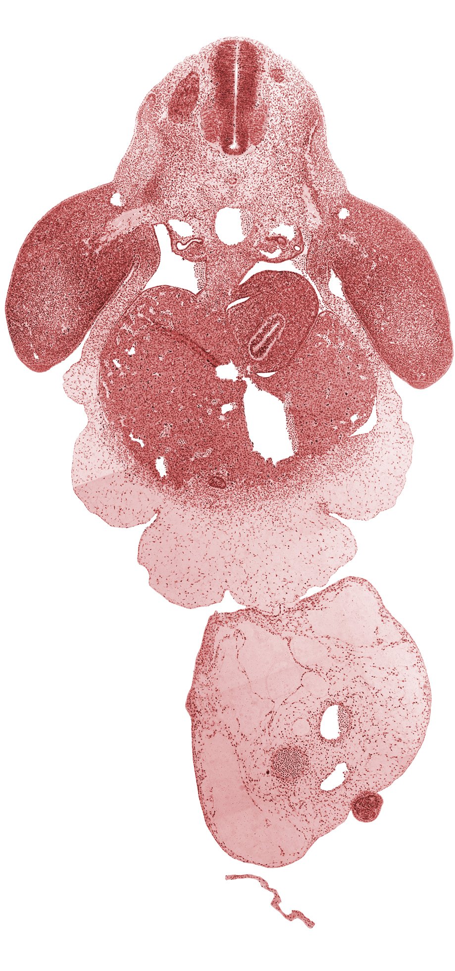 aorta, brachial plexus, caudal part of pericardial sac, cephalic edge of C-8 spinal ganglion, common umbilical vein, dermatome, dorsal mesogastrium, ductus venosus, gall bladder primordium, junction of mesonephric duct and tubule, left lobe of liver, left umbilical artery, lesser  sac, myotome, neural tube, post anal gut, postcardinal vein, right lobe of liver, right umbilical artery, septum transversum, stomach, tip of caudal eminence, umbilical coelom, umbilical cord, upper limb