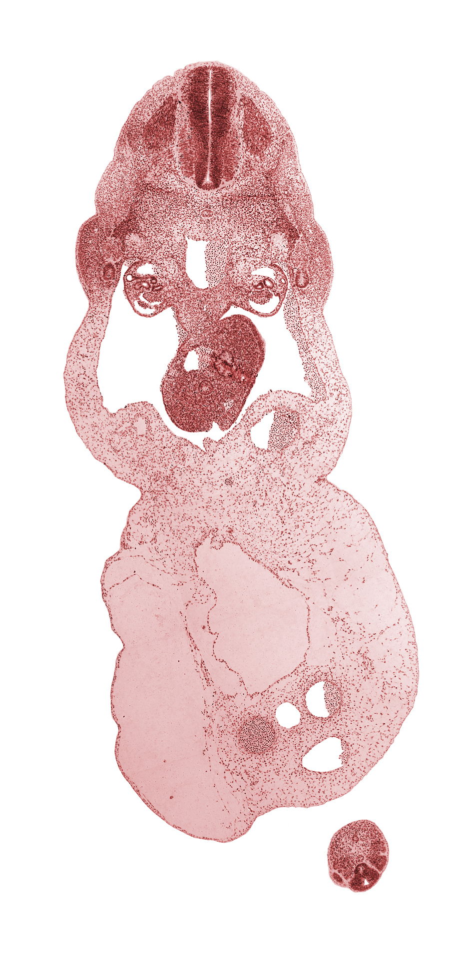 T-1 spinal ganglion, allantois, aorta, coccygeal somites, dorsal pancreas, duodenum, glomerular capsule, involuting right umbilical vein, left umbilical artery, left umbilical vein, mammary crest, mesonephric duct, neural tube, notochord, omphalomesenteric (superior mesenteric) vein, peritoneal cavity, post anal gut, postcardinal vein, right umbilical artery, umbilical coelom, ventral pancreas