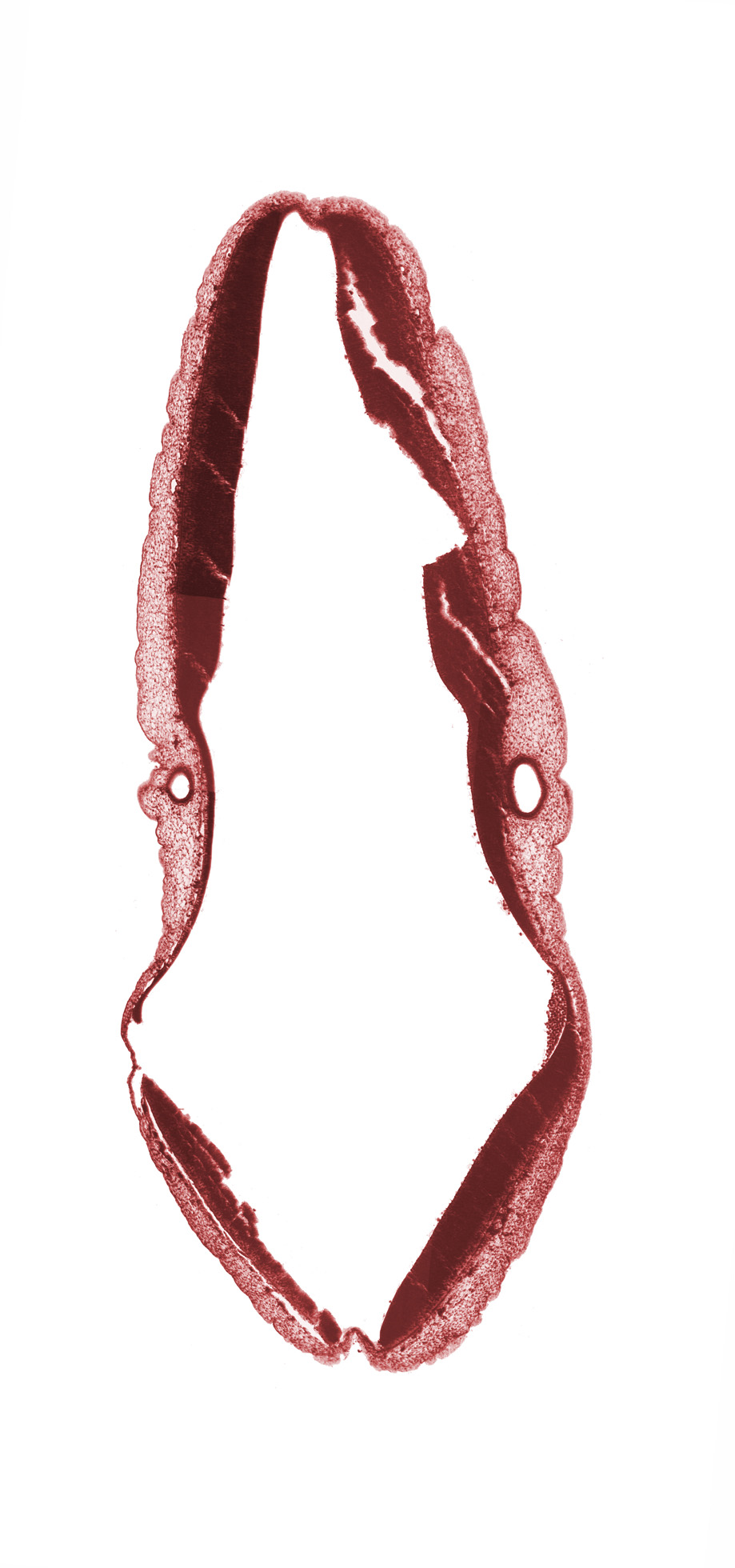 alar plate of metencephalon (primordium of cerebellum), alar plate of myelencephalon, edge of endolymphatic duct, endolymphatic duct part of otic vesicle, head mesenchyme, rhombencoel (fourth ventricle), roof plate