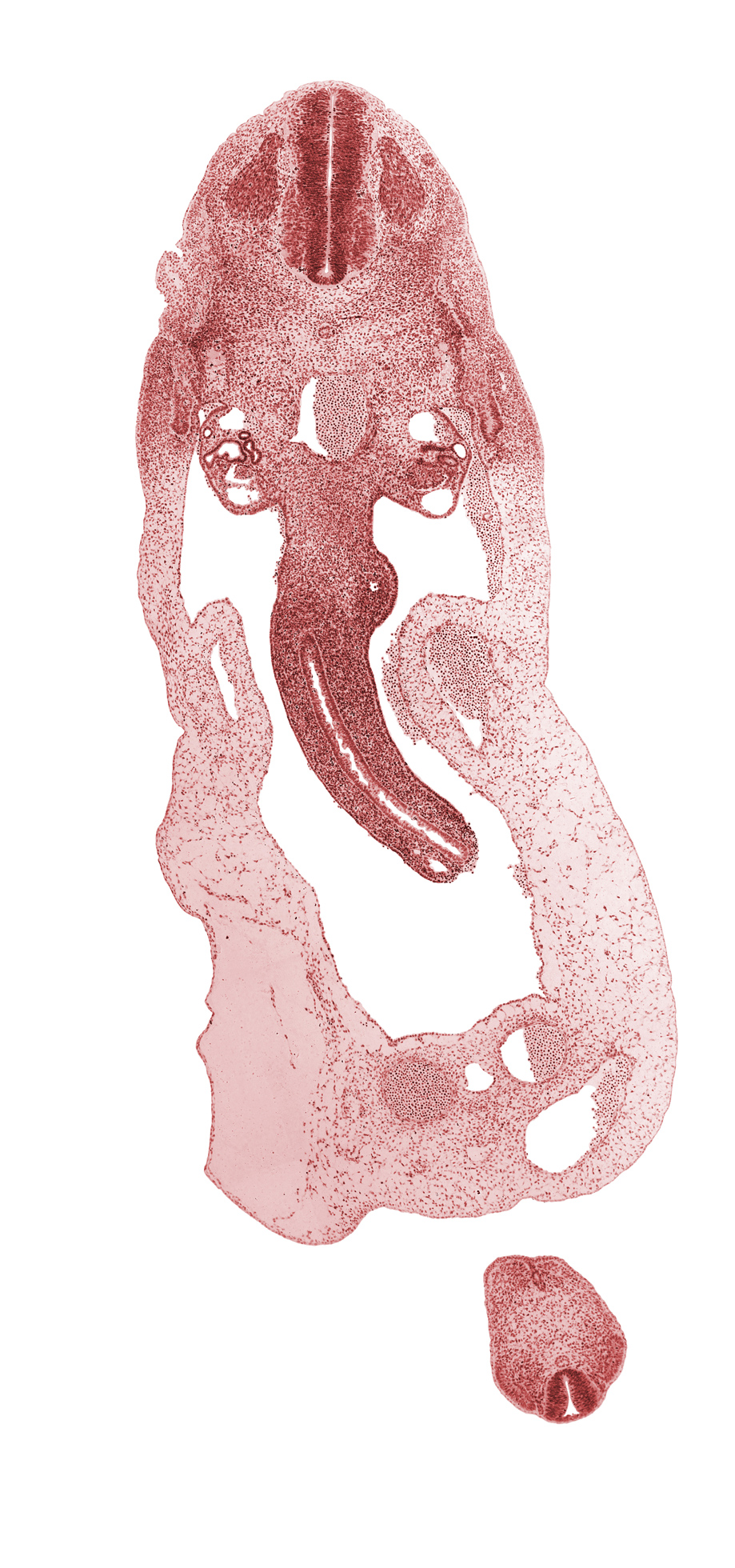 S-4 spinal ganglion, T-2 spinal ganglion, allantois, anal tubercle, cloacal membrane, dermatomyotome, dorsal mesentery, involuting right umbilical vein, left umbilical artery, left umbilical vein, mammary crest, mesonephric artery, mesonephric duct, midgut loop, neural tube, notochord, peritoneal cavity, postcardinal vein, right umbilical artery, superior mesenteric artery, umbilical coelom