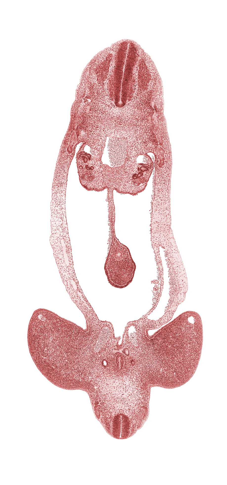 S-1 spinal ganglion, T-4 spinal ganglion, abdominal wall, alar plate(s), aorta, basal plate, dermatomyotome, dorsal mesentery, floor plate, gonadal ridge, hindgut, internal iliac artery, limb mesenchyme, lower limb, mesonephric duct, mesonephric tubule(s), mesothelium, midgut loop, notochord, peritoneal cavity, postcardinal vein, right umbilical artery, roof plate, sclerotome, sulcus limitans