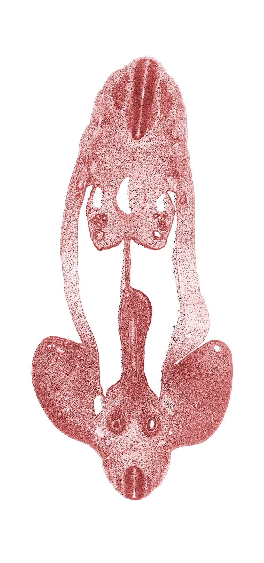 L-5 spinal ganglion, T-4 spinal ganglion, alar plate(s), aorta, basal plate, cephalic edge of metanephric diverticulum, dermatome, distal limb of midgut loop, dorsal mesentery, floor plate, gonadal ridge, hindgut, inferior mesenteric artery, junction of hindgut and midgut, lower limb, mesonephric duct, mesonephric tubule(s), metanephric cap, metanephric diverticulum, myotome, notochord, peritoneal cavity, postcardinal vein, roof plate, sclerotome, sulcus limitans