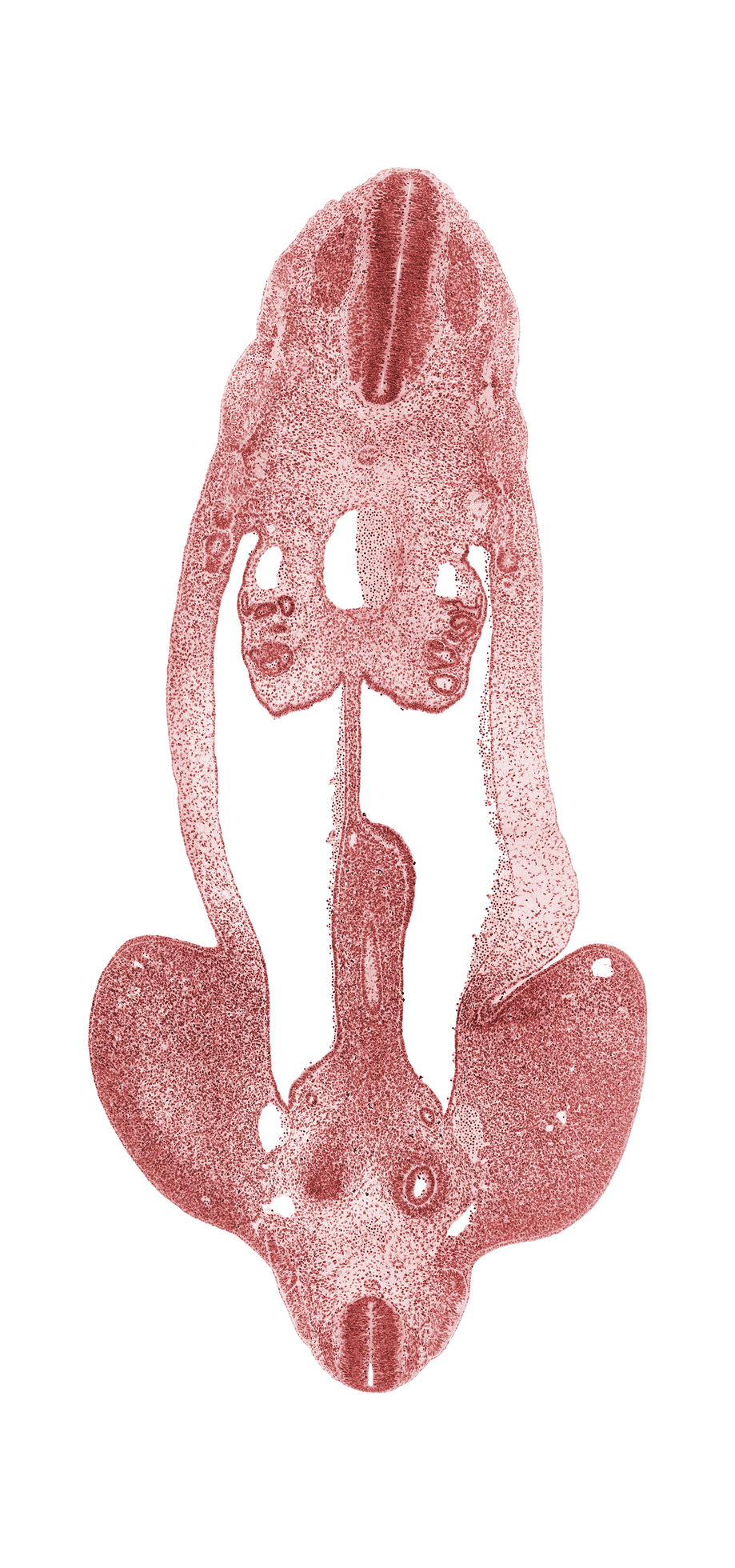 L-5 spinal ganglion, T-4 spinal ganglion, abdominal wall, aorta, cephalic edge of metanephric cap, common iliac artery, dorsal mesentery, edge of hindgut, external iliac artery, gonadal ridge, inferior mesenteric artery, intermediate zone, internal iliac artery, junction of mesonephric duct and tubule, marginal zone, mesonephric duct, mesonephric vesicle(s), metanephric cap, metanephric diverticulum, notochord, postcardinal vein, ventricular zone