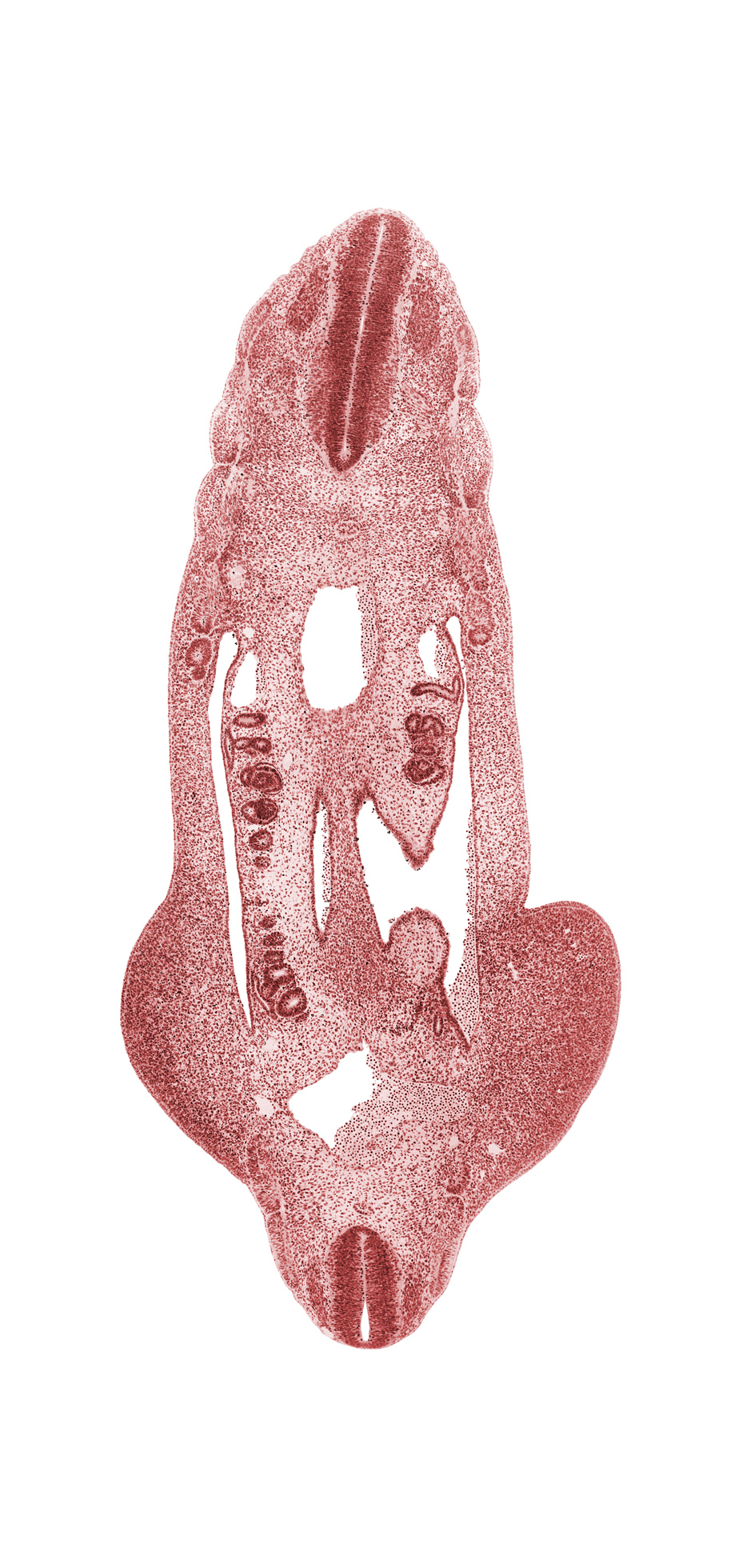 L-4 spinal ganglion, T-5 spinal ganglion, aorta, aortic bifurcation, dense caudal part of sclerotome, dorsal mesentery, gonadal ridge, hip region, inferior mesenteric artery, junction of mesonephric duct and tubule, mesonephric duct, mesonephric vesicle(s), myotome, notochord, peritoneal cavity, postcardinal vein, surface ectoderm