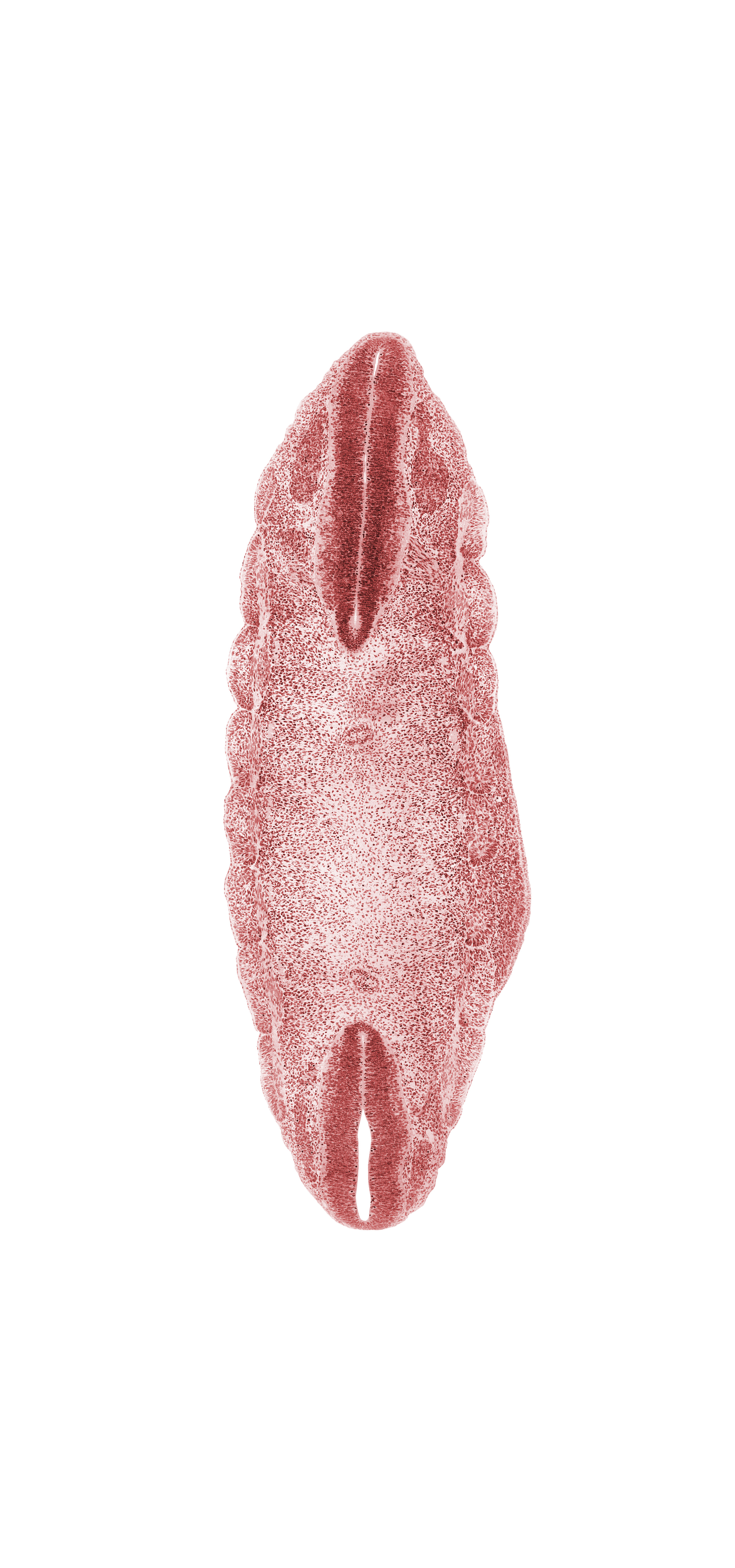 L-2 spinal ganglion, L-3 spinal ganglion, T-6 spinal ganglion, T-7 body segment, T-7 spinal ganglion, T-8 body segment, T-9 body segment, alar plate(s), basal plate, dense caudal part of sclerotome, floor plate, loose cephalic part of sclerotome, myotome, notochord, roof plate, somite remnant, sulcus limitans, surface ectoderm