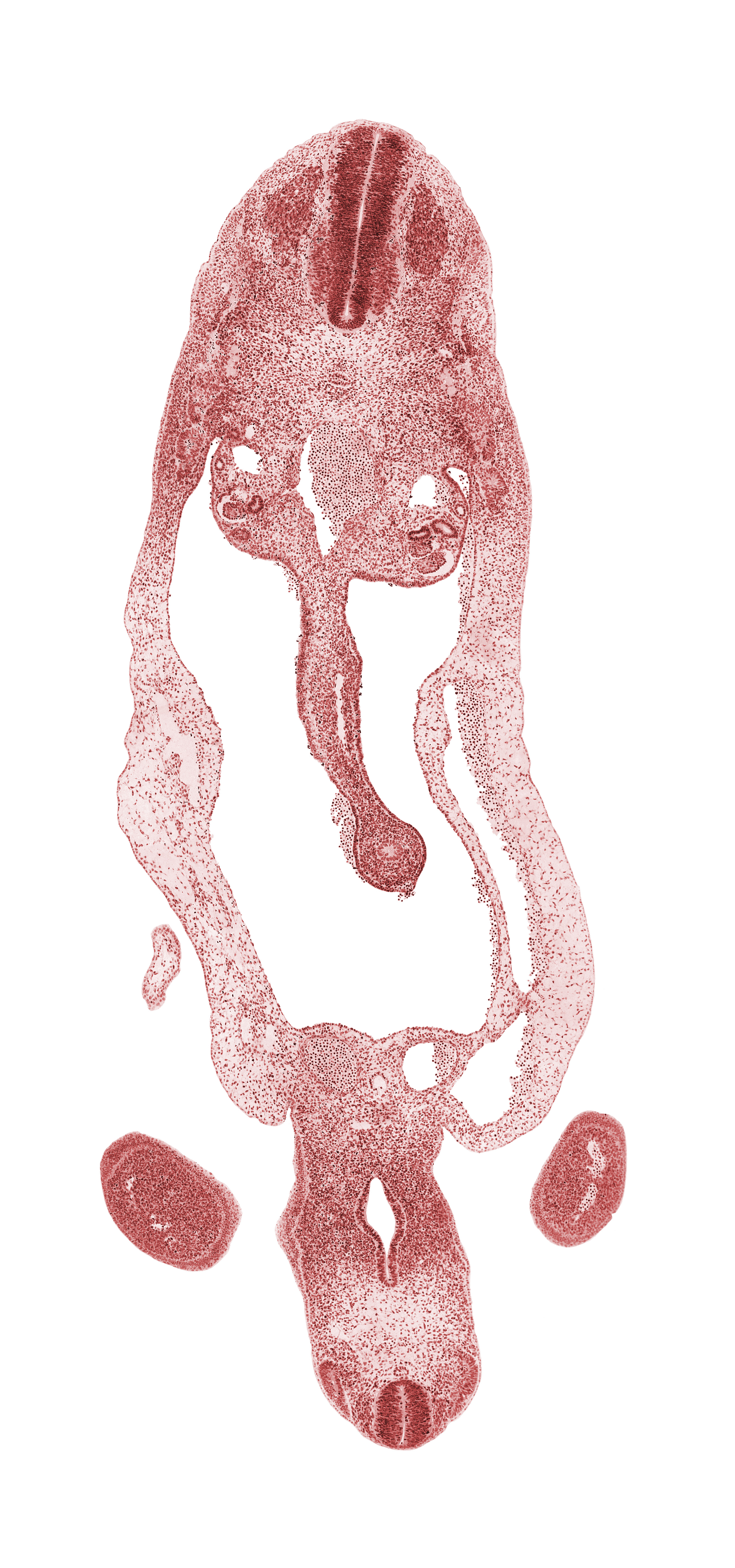 S-2 spinal ganglion, T-3 spinal ganglion, allantois, cloaca, dermatome, dermatomyotome, ectoderm, hindgut, involuting right umbilical vein, left umbilical artery, left umbilical vein, lower limb, mammary crest, marginal vein, mesonephric duct, mesonephros, mesothelium, midgut loop, myotome, notochord, omphalomesenteric (superior mesenteric) vein, peritoneal cavity, postcardinal vein, right umbilical artery, sclerotome