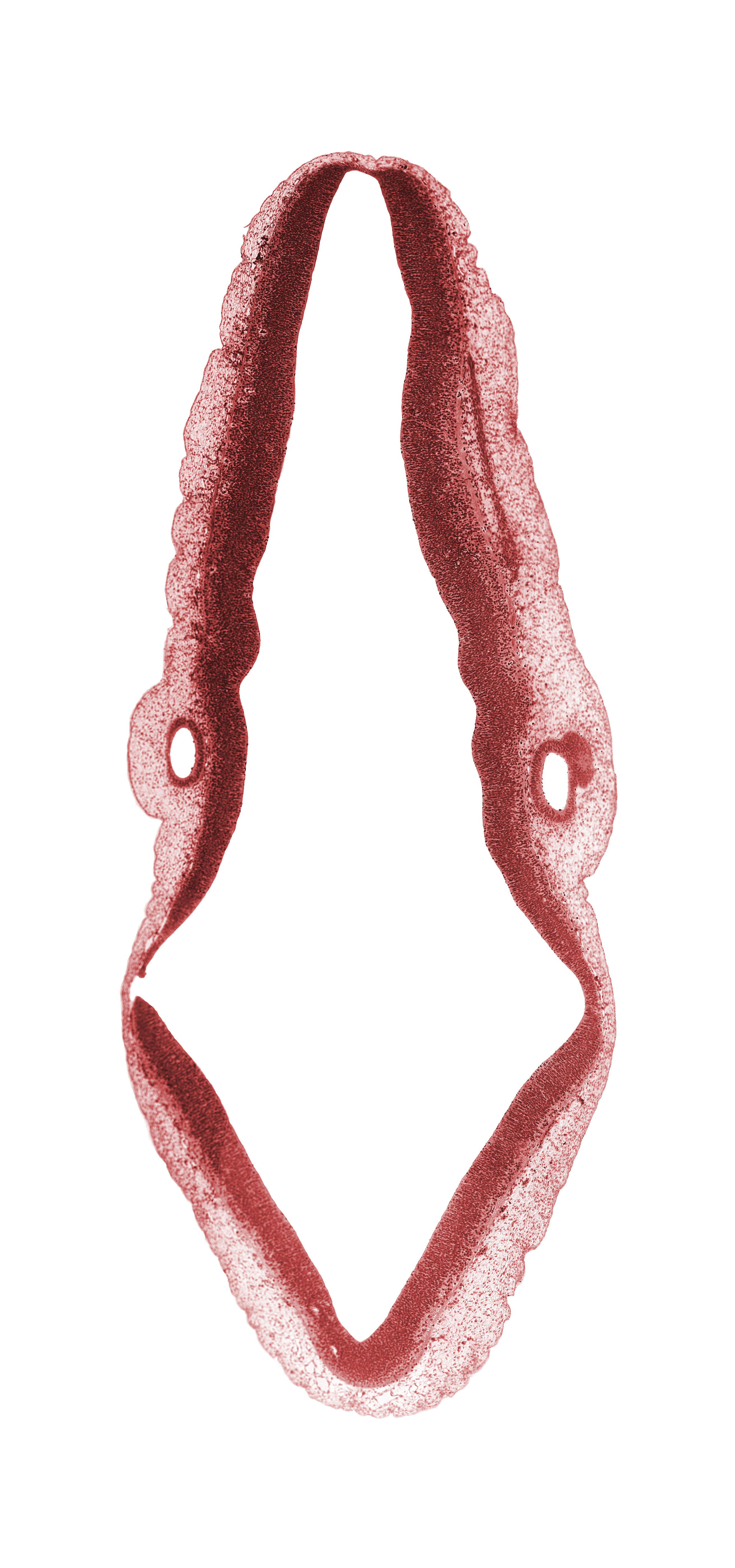 alar plate of metencephalon (primordium of cerebellum), alar plate(s), basal plate, caudal part of myelencephalon (rhombomere D), cephalic edge of superior ganglion of vagus nerve (CN X), cephalic edge of vestibular part of otic vesicle, endolymphatic duct part of otic vesicle, isthmus of rhombencephalon, junction of accessory and vagus nerves (CN XI and CN X), rhombencoel (fourth ventricle), rhombomere 6, rhombomere 7, roof plate, spinal accessory nerve (CN XI), sulcus limitans, surface ectoderm, transverse rhombencephalic sulcus