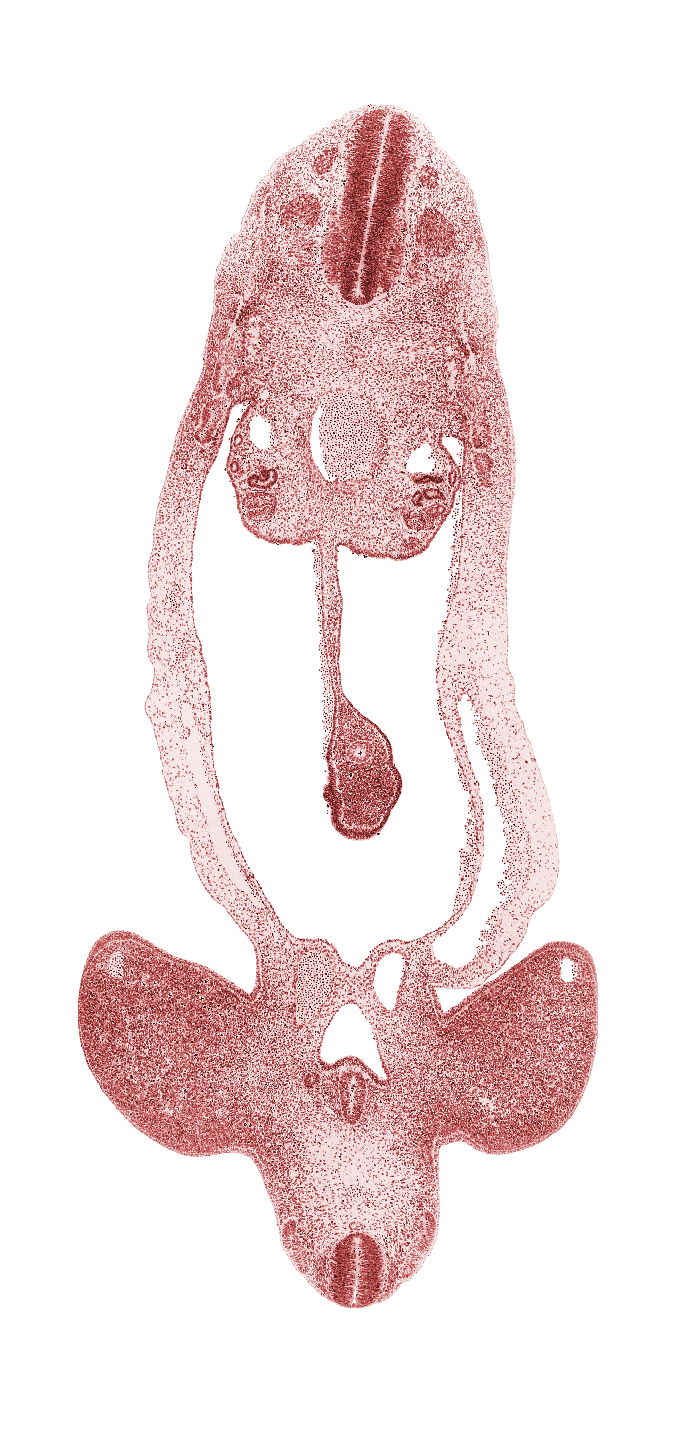 S-1 spinal ganglion, aorta, caudal part of T-3 spinal ganglion, cephalic part of T-4 spinal ganglion, cloaca, dorsal mesentery, hindgut, involuting right umbilical vein, junction of cloaca and mesonephric duct, left umbilical artery, left umbilical vein, limb mesenchyme, lower limb, marginal vein, mesonephric duct, mesonephros, midgut loop, neural canal, neural tube, notochord, right umbilical artery, sclerotome, somite remnant