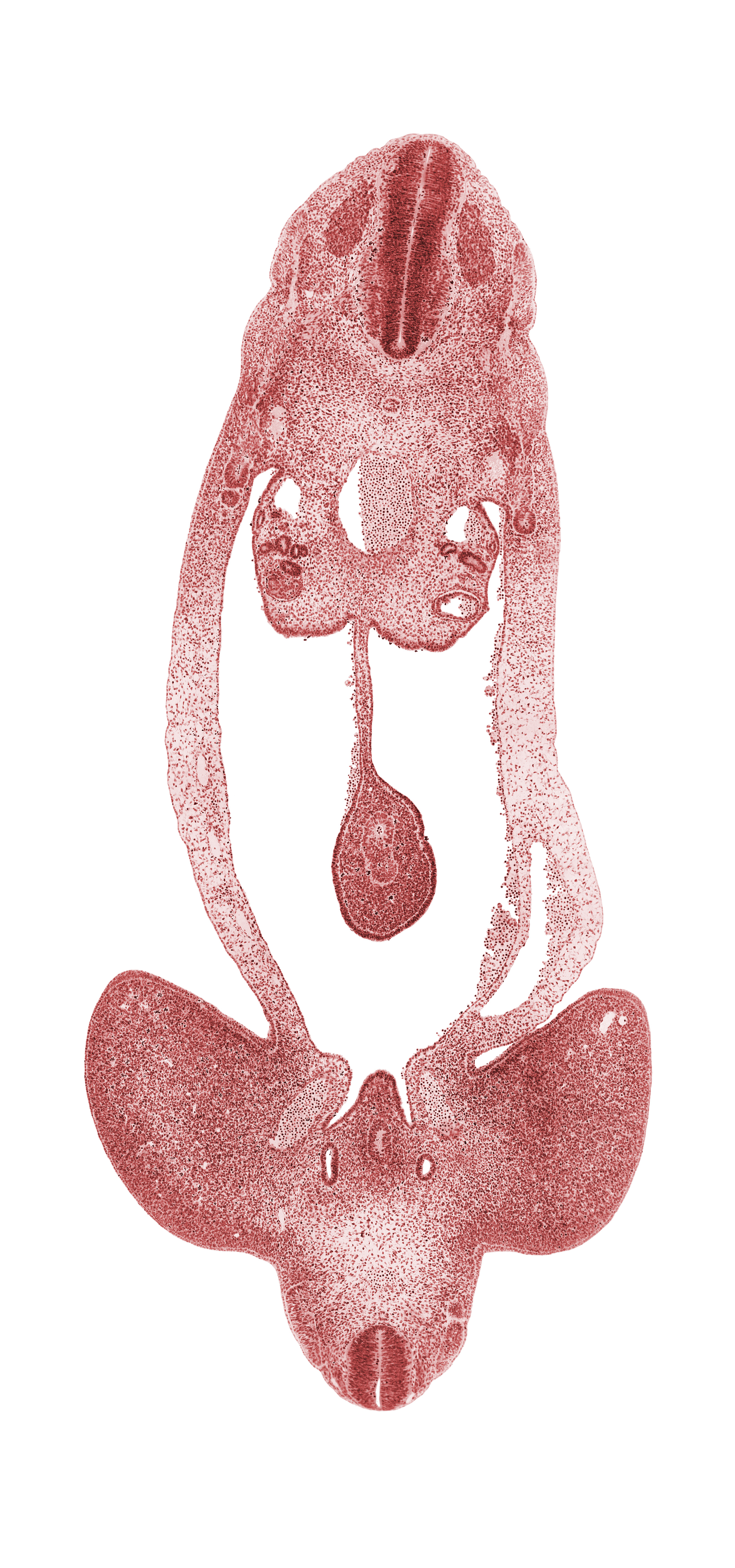 S-1 spinal ganglion, T-4 spinal ganglion, abdominal wall, aorta, dermatome, distal limb of midgut loop, dorsal mesentery, external iliac artery, gonadal epithelium, hindgut, junction of mesonephric duct and metanephric diverticulum, left umbilical vein, lower limb, marginal vein, mesonephric duct, mesothelium, myotome, notochord, peritoneal cavity, postcardinal vein, right umbilical artery, sclerotome, surface ectoderm