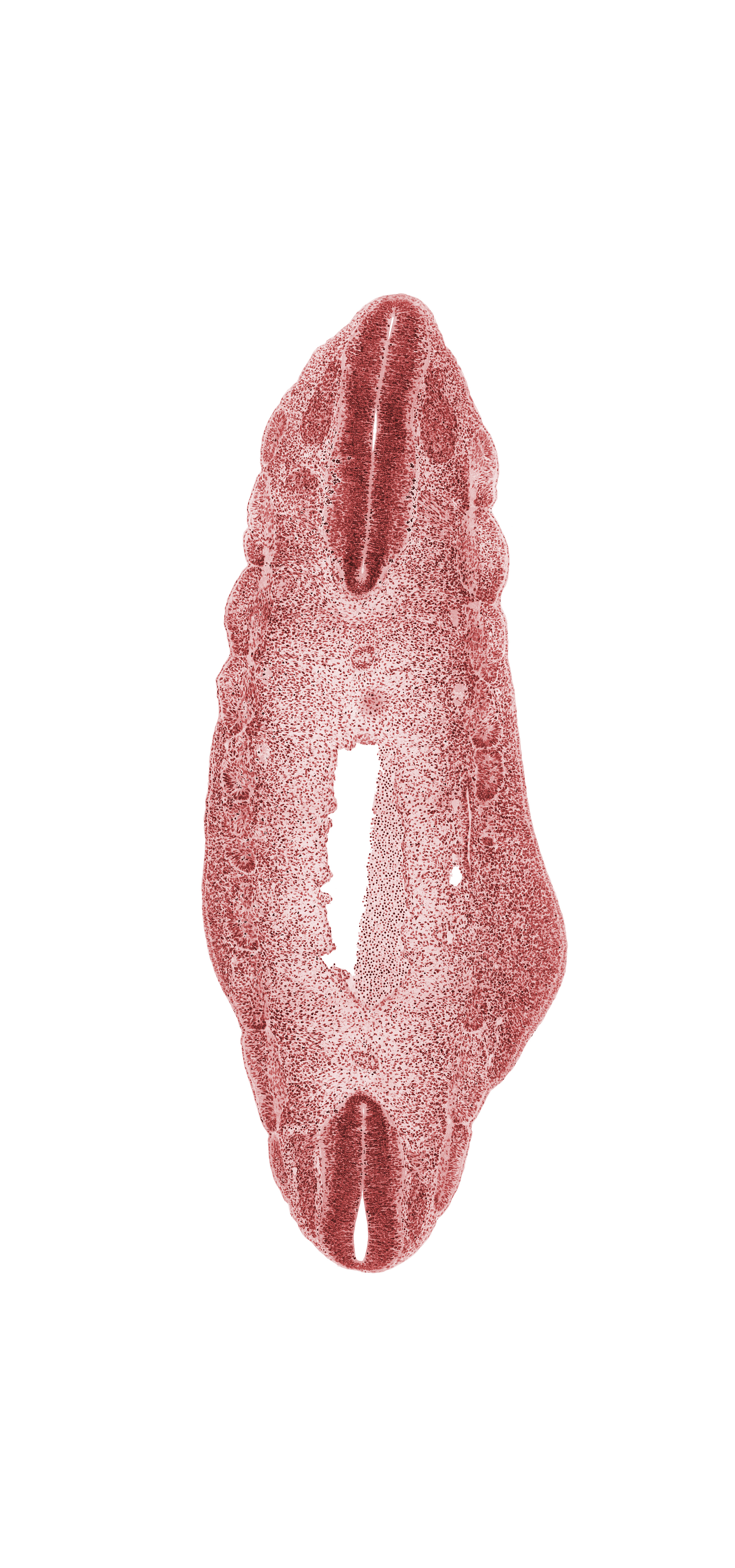 L-3 spinal ganglion, T-5 spinal ganglion, T-6 body segment, T-6 spinal ganglion, T-7 body segment, alar plate(s), aorta, basal plate, dermatome, edge of peritoneal cavity, floor plate, hip region, myotome, neural canal, notochord, roof plate, sulcus limitans