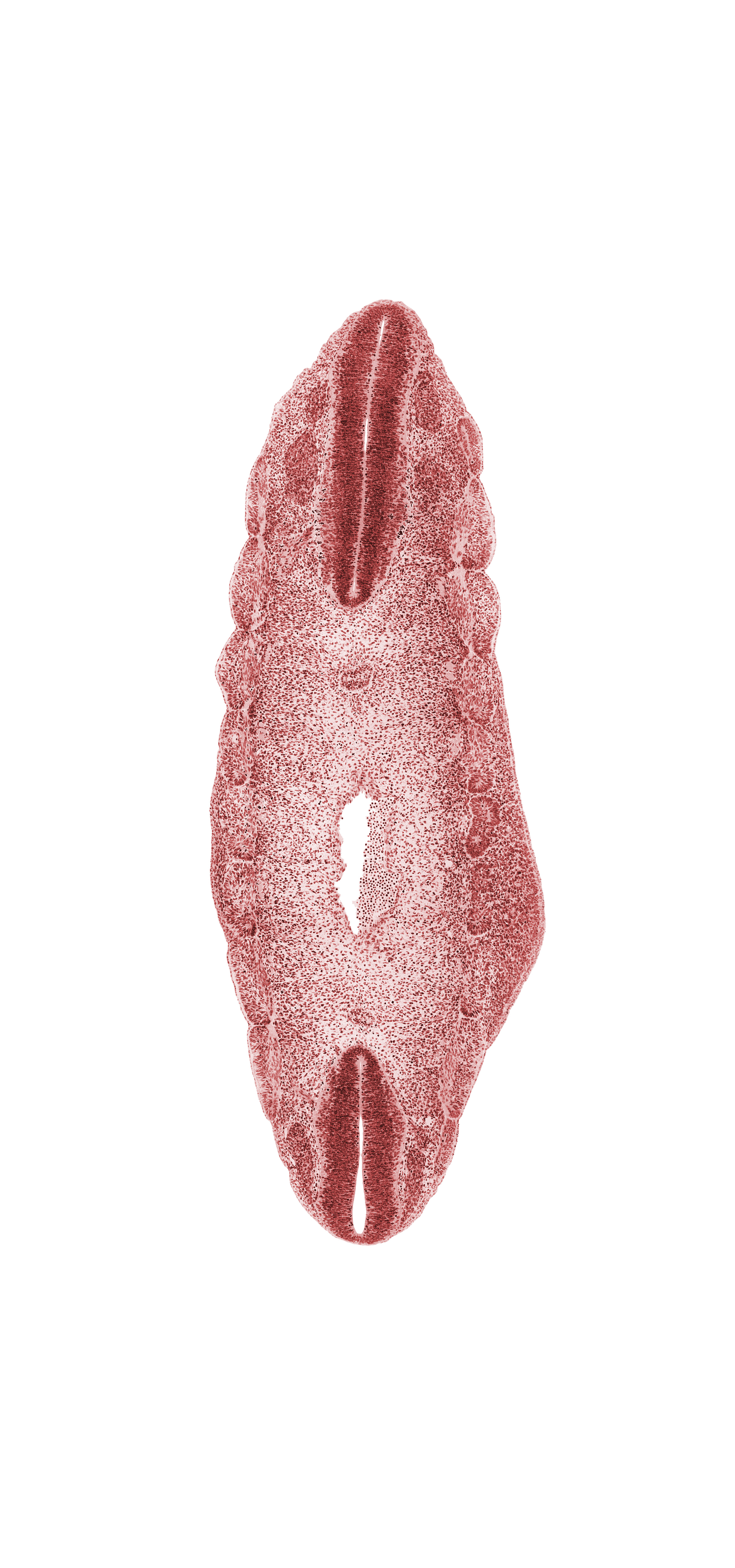 L-2 spinal ganglion, L-3 spinal ganglion, T-6 spinal ganglion, T-7 body segment, T-7 spinal ganglion, T-8 body segment, dermatome, edge of aorta, hip region, intersegmental groove, myotome, notochord, sclerotome, somite remnant