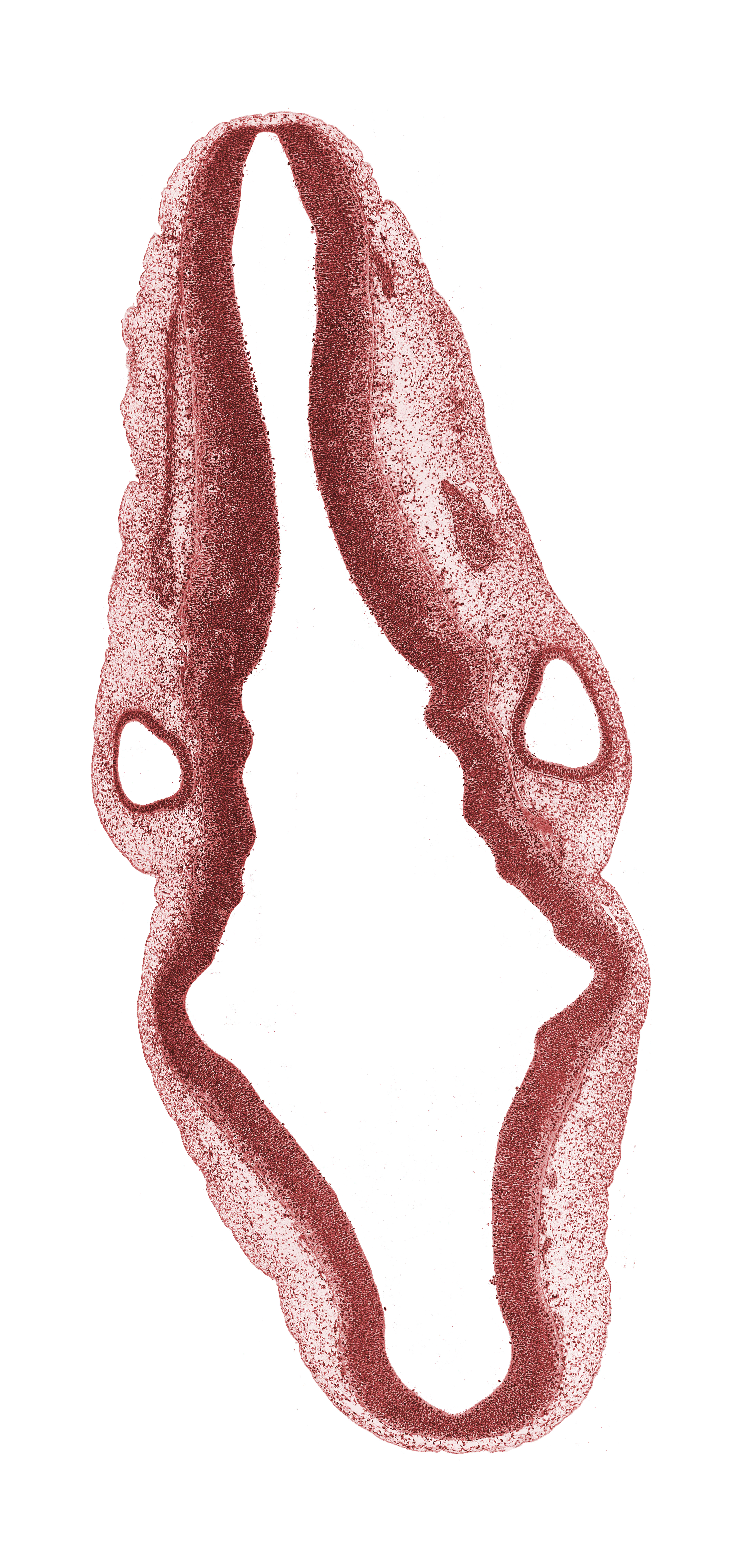 alar plate(s), basal plate of metencephalon, isthmus of rhombencephalon, mesencephalon (M2), posterior dural venous plexus, rhombencoel (fourth ventricle), rhombomere 1, rhombomere 2, rhombomere 5, rhombomere 6, roof plate, spinal accessory nerve (CN XI), sulcus limitans, superior ganglion of vagus nerve (CN X), transverse rhombencephalic sulcus, vestibular part of otic vesicle