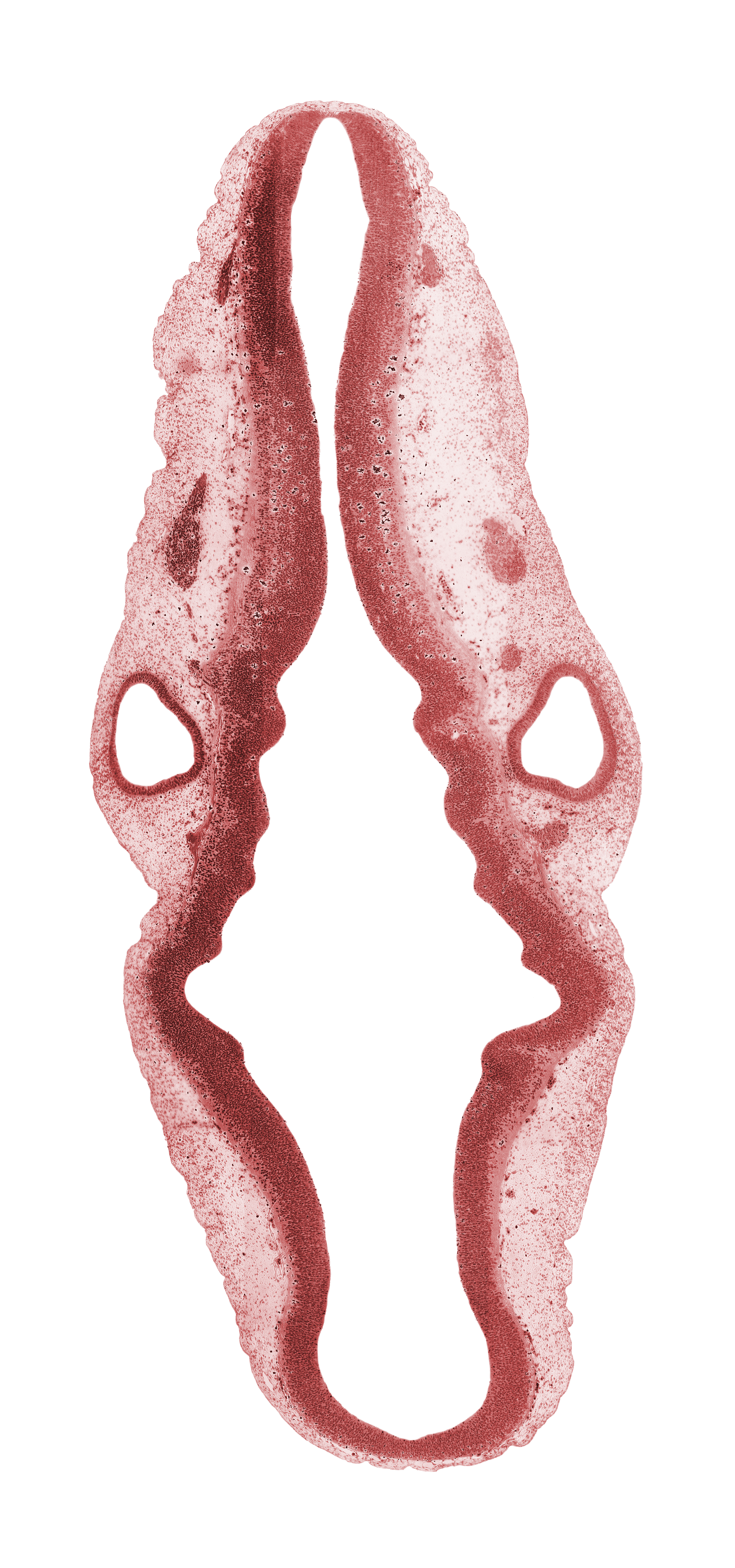 alar plate(s), basal plate, cephalic edge of vestibulocochlear / geniculate ganglia, isthmus of rhombencephalon, mesencephalon (M2), mesencoel (cerebral aqueduct), myelencephalon, posterior dural venous plexus, rhombomere 1, rhombomere 2, rhombomere 3, rhombomere 4, rhombomere 5, spinal accessory nerve (CN XI), sulcus limitans, superior ganglion of glossopharyngeal nerve (CN IX), superior ganglion of vagus nerve (CN X), transverse rhombencephalic sulcus, vestibular part of otic vesicle