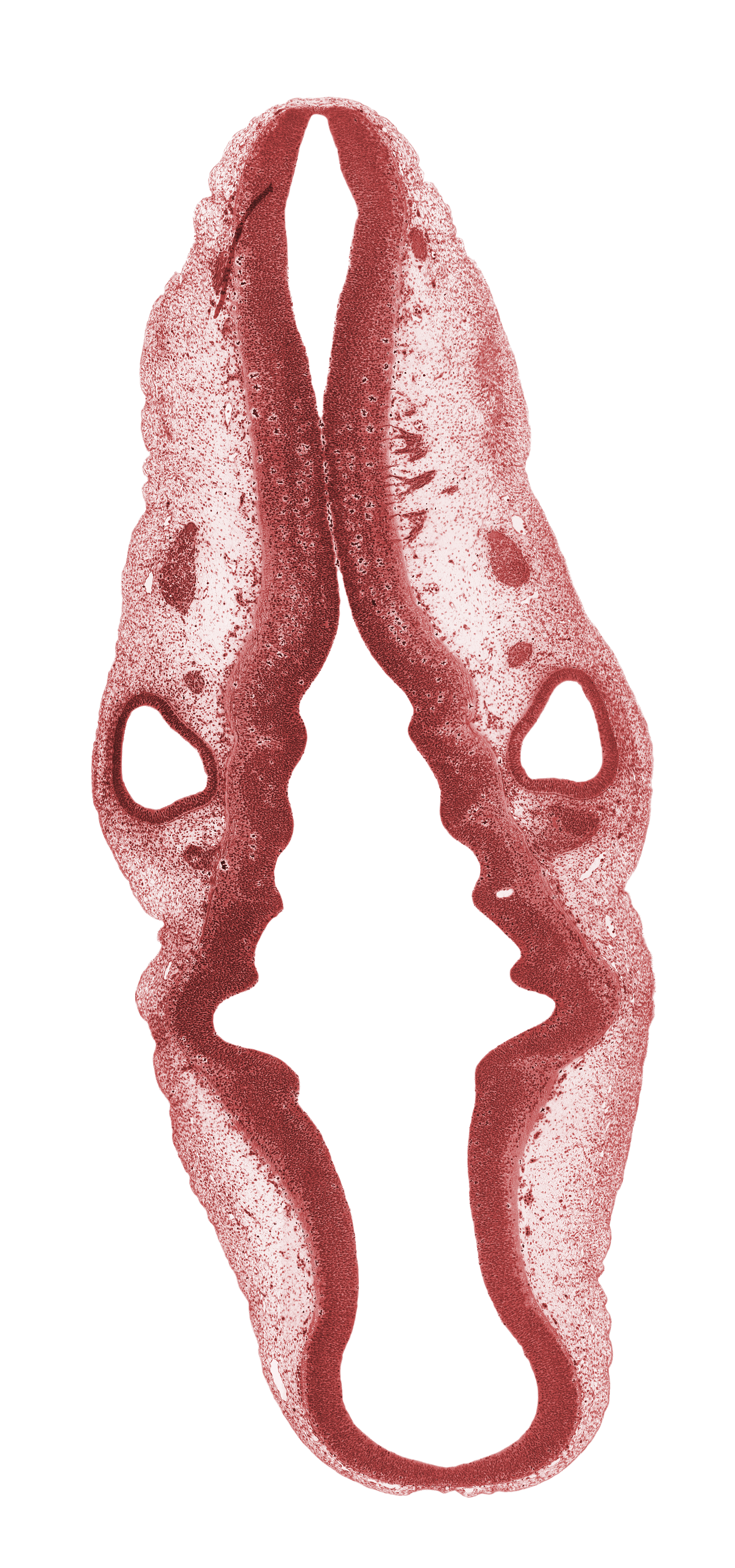 anterior dural venous plexus, geniculate and vestibulocochlear ganglia (CN VII and CN VIII), isthmus of rhombencephalon, mesencephalon (M2), middle dural venous plexus, myelencephalon (caudal part of rhombencephalon), posterior dural venous plexus, rhombomere 1, rhombomere 2, rhombomere 4, rhombomere 6, root of hypoglossal nerve (CN XII), spinal accessory nerve (CN XI), sulcus limitans, superior ganglion of glossopharyngeal nerve (CN IX), superior ganglion of vagus nerve (CN X), surface ectoderm