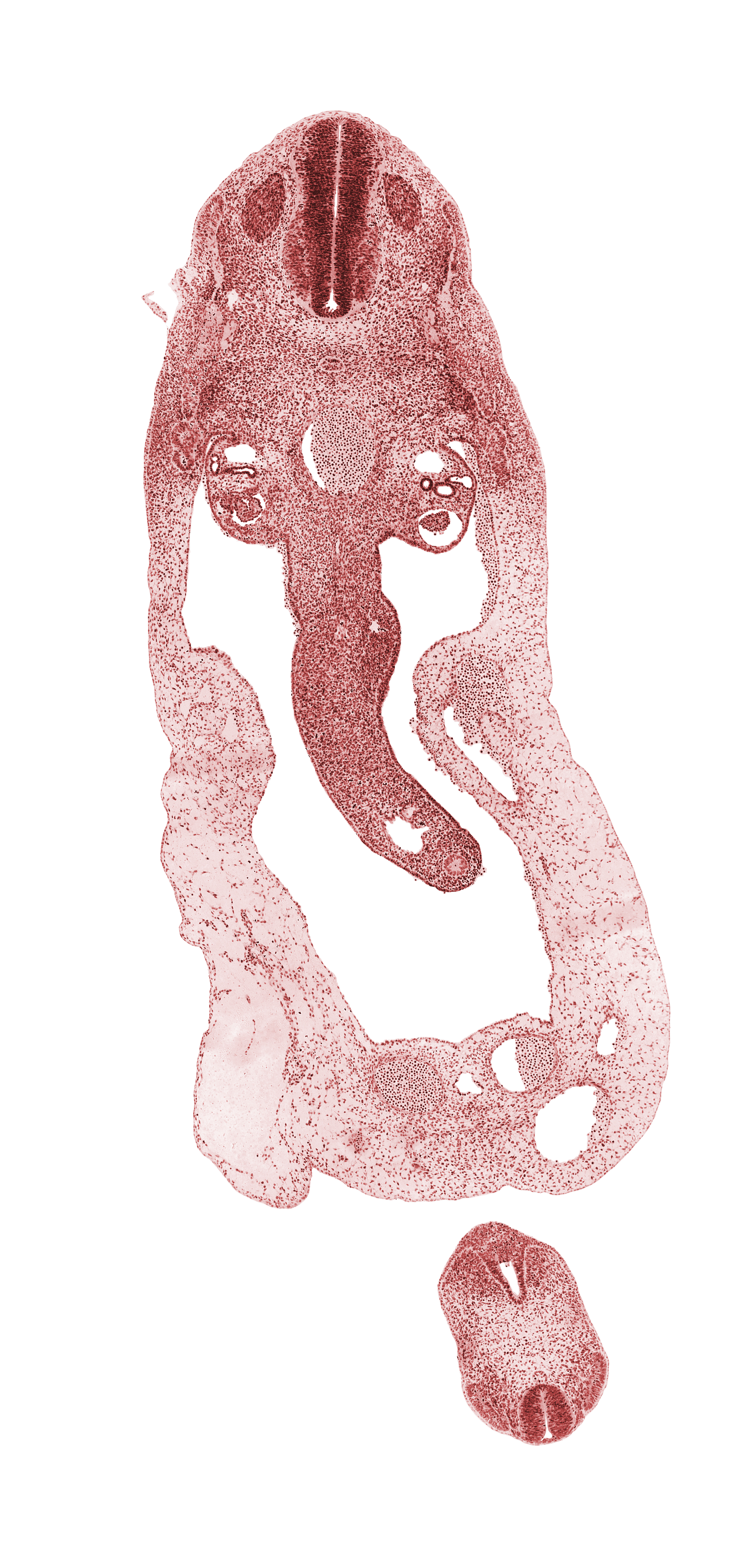 S-3 / S-4 interganglion region, T-2 spinal ganglion, alar plate(s), allantois, aorta, basal plate, cloaca, cloacal membrane, dermatomyotome, dorsal mesentery, floor plate, gonadal ridge, left umbilical artery, left umbilical vein, mammary crest, mesonephros, midgut loop, myotome, neural tube, notochord, omphalomesenteric (superior mesenteric) vein, peritoneal cavity, right umbilical artery, roof plate, sulcus limitans, superior mesenteric artery, surface epithelium, umbilical coelom