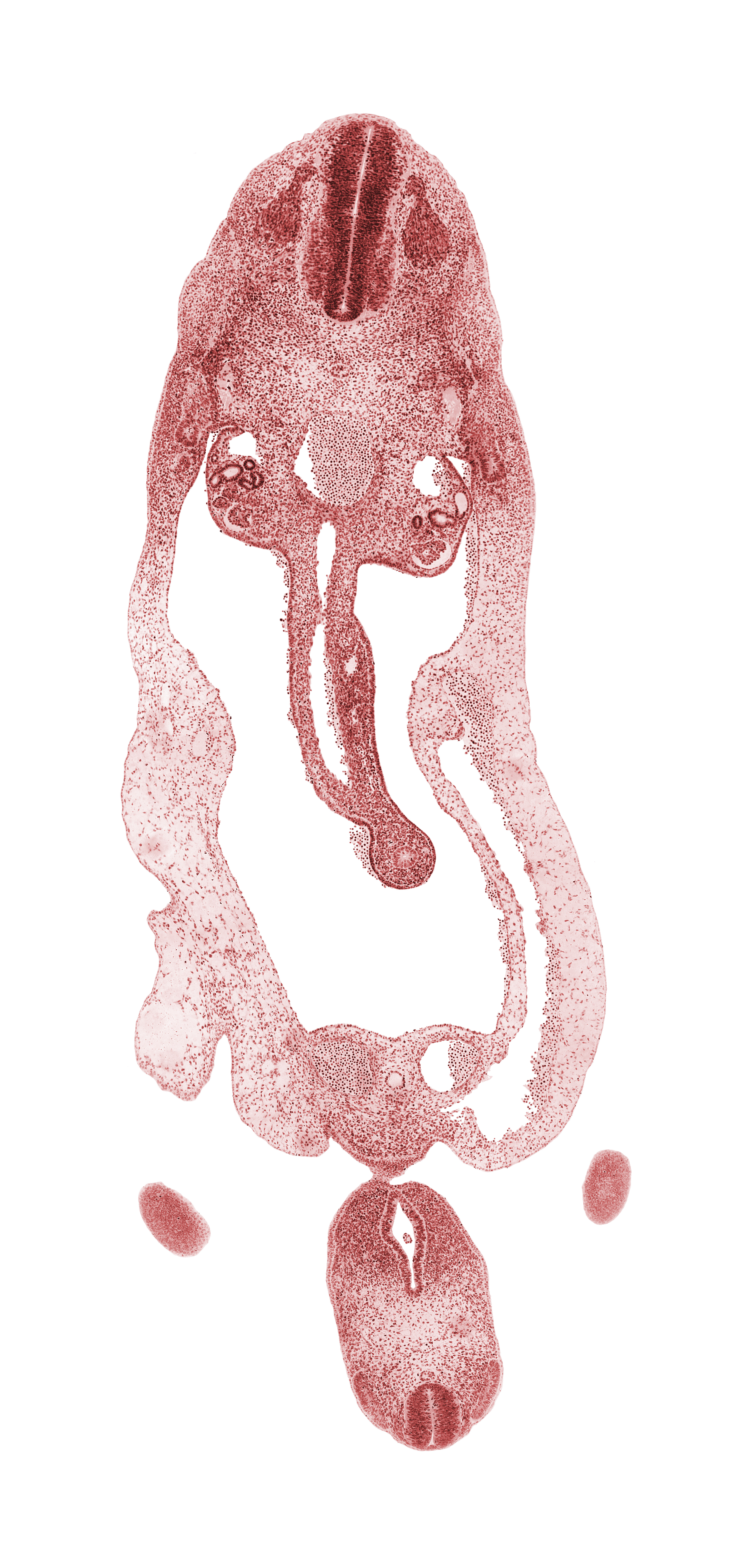 T-3 spinal ganglion, aorta, cephalic edge of lower limb, cloaca, cloacal membrane, dermatomyotome, dorsal mesentery, genital tubercle, glomerulus, gonadal epithelium, left umbilical vein, mammary crest, mesonephros, midgut loop, myotome, neural tube, notochord, omphalomesenteric (superior mesenteric) vein, peritoneal cavity, postcardinal vein, sclerotome, superior mesenteric artery, umbilical coelom