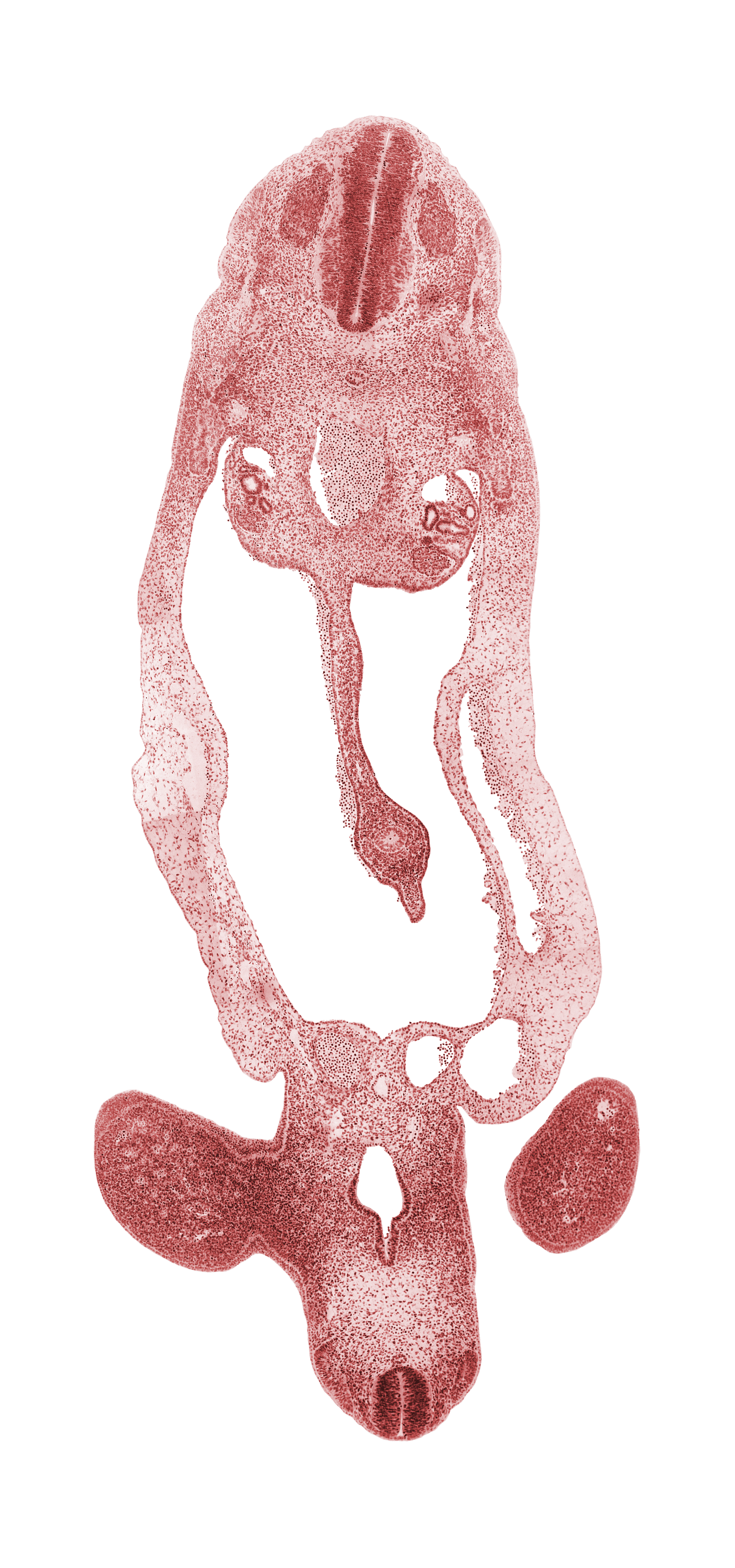 S-2 spinal ganglion, T-3 spinal ganglion, abdominal wall, allantois, aorta, cloaca, dermatome, dermatomyotome, dorsal mesentery, gonadal ridge, hindgut, involuting right umbilical vein, junction of lower limb and pelvic region, left umbilical vein, lower limb, mammary crest, mesonephric duct, midgut loop, myotome, notochord, peritoneal cavity, postcardinal vein, sclerotome