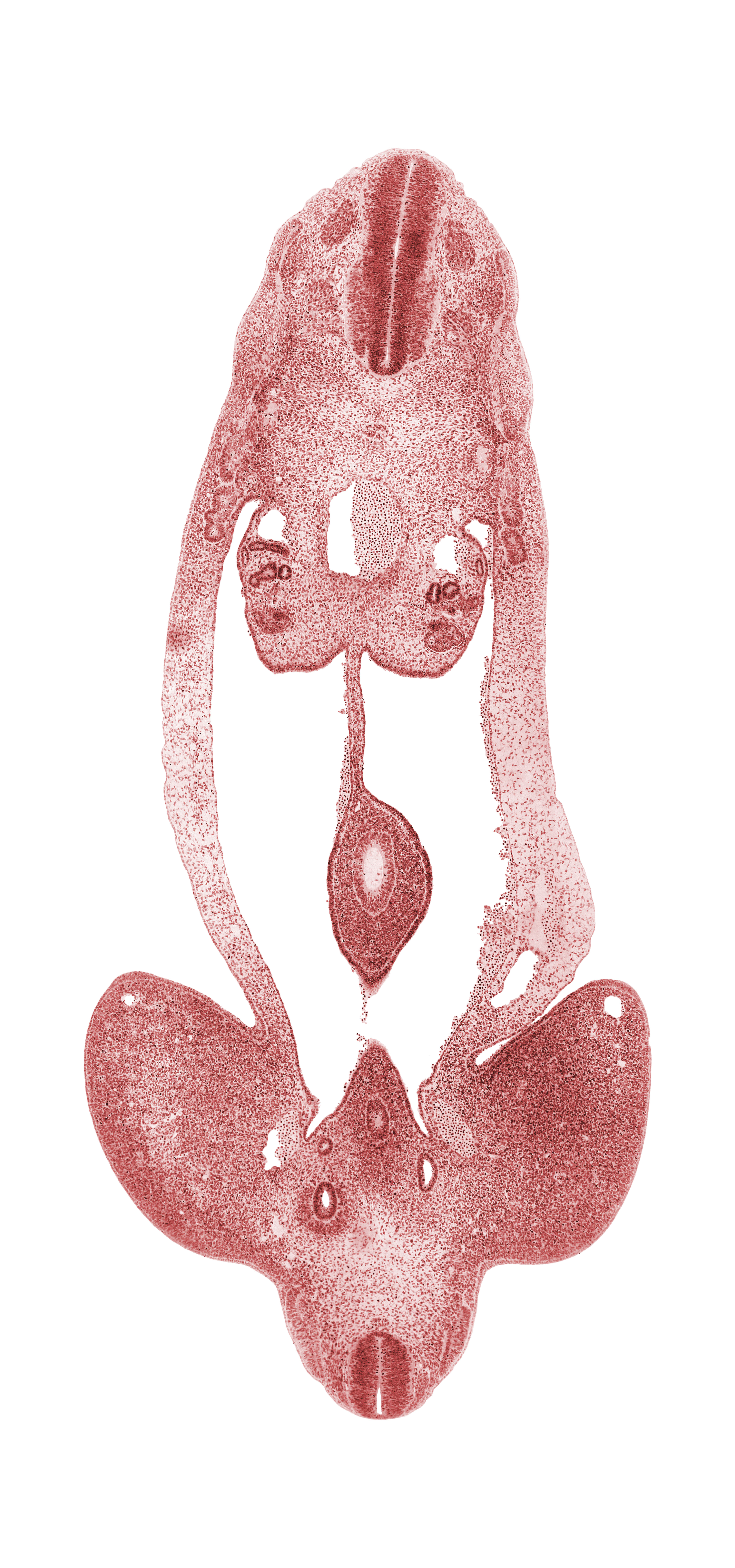 L-5 / S-1 interganglion region, T-4 spinal ganglion, abdominal wall, aorta, cecum of midgut, common iliac artery, dermatome, dorsal mesentery, edge of left umbilical vein, gonadal ridge, hindgut, internal iliac artery, junction of mesonephric duct and metanephric diverticulum, lower limb, marginal vein, mesonephric duct, metanephric diverticulum, myotome, notochord, peritoneal cavity, postcardinal vein, sclerotome