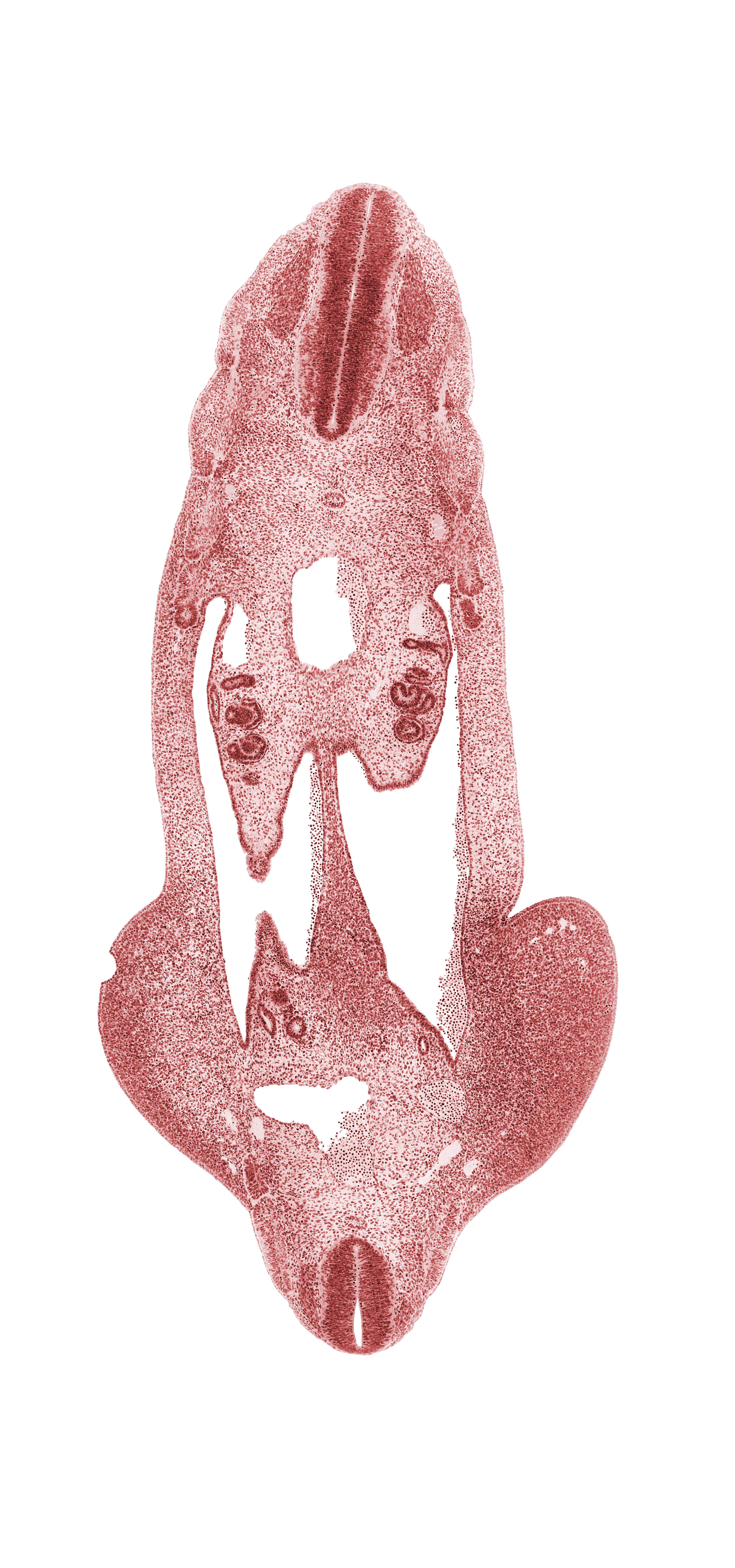 L-4 / L-5 interganglion region, T-4 spinal ganglion, T-5 spinal ganglion, abdominal wall, aorta, aortic bifurcation, dorsal mesentery, inferior mesenteric artery, junction of mesonephric duct and tubule, limb mesenchyme, marginal vein, mesonephric duct, neural canal, notochord, peritoneal cavity, postcardinal vein, right common iliac artery, splanchnic mesenchyme