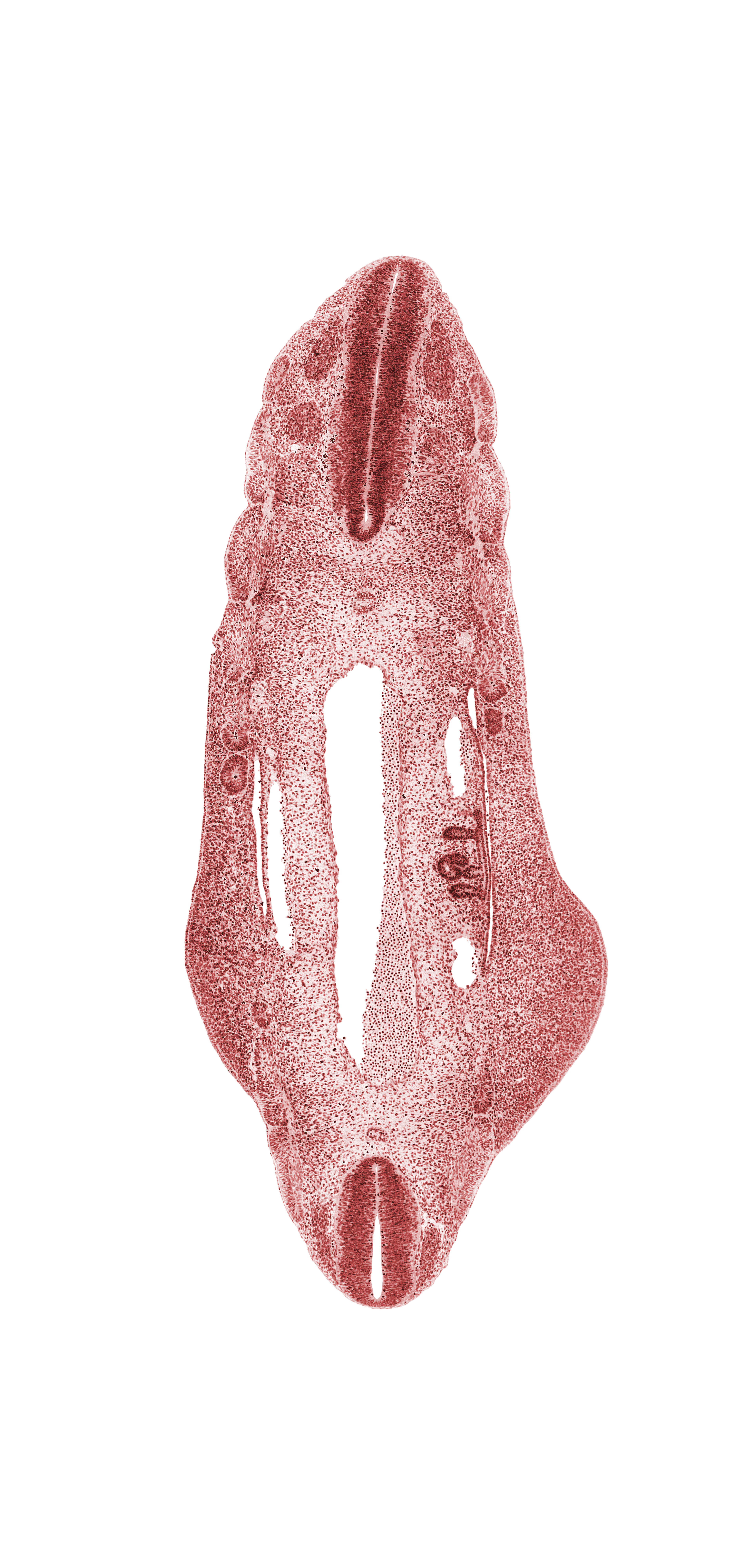 L-3 spinal ganglion, T-5 spinal ganglion, T-6 body segment, continuity of aorta, continuity of caudal and cephalic parts of mesonephric duct, continuity of postcardinal vein, dense caudal part of sclerotome, edge of peritoneal cavity, hip region, intermediate zone, marginal zone, notochord, postcardinal vein, ventricular zone