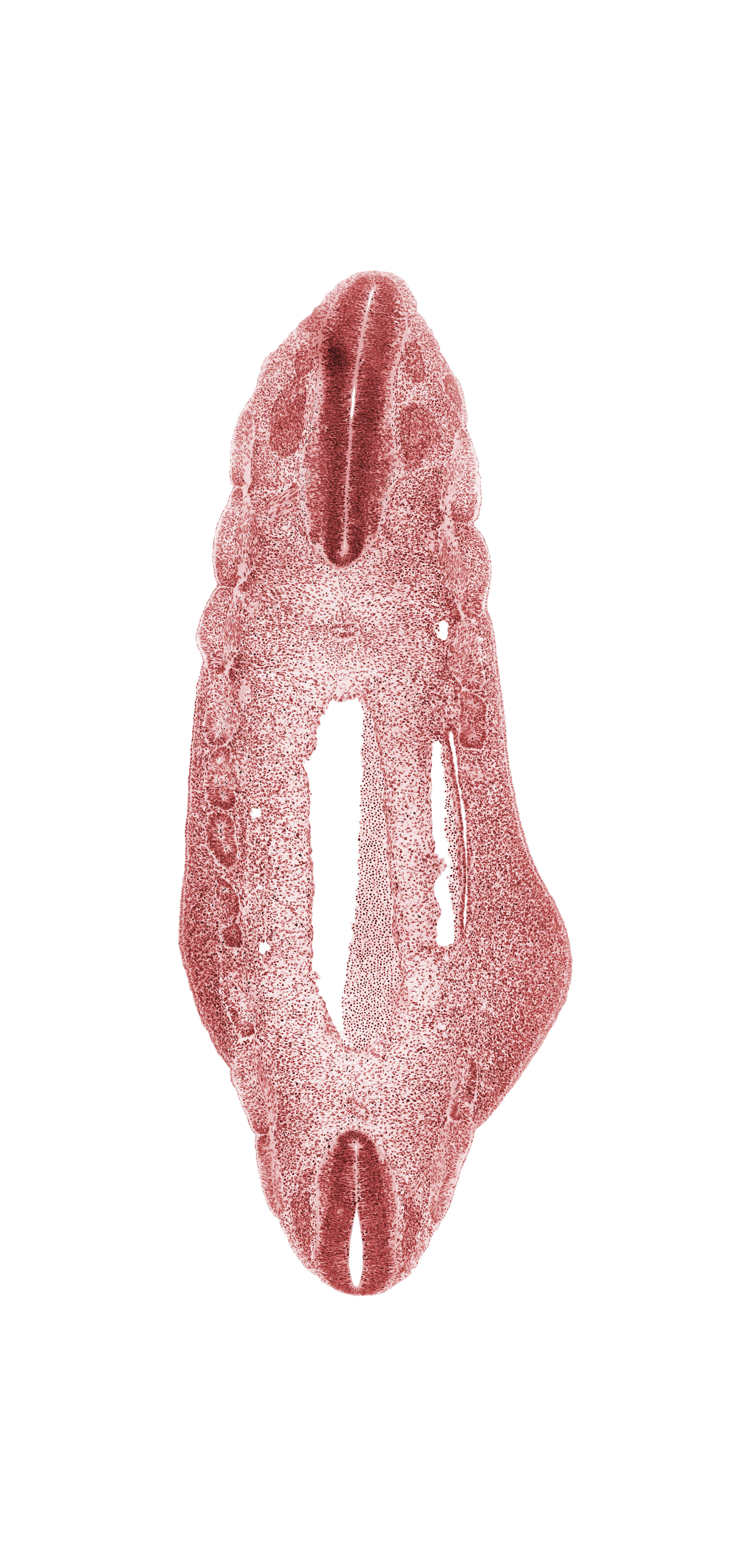 L-3 spinal ganglion, T-5 spinal ganglion, T-6 body segment, T-6 spinal ganglion, T-7 body segment, aorta, continuity of postcardinal vein, dense caudal part of sclerotome, dermatome, edge of peritoneal cavity, hip region, myotome, neural canal, neural tube, notochord