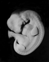 Left lateral view of the embryo prior to sectioning