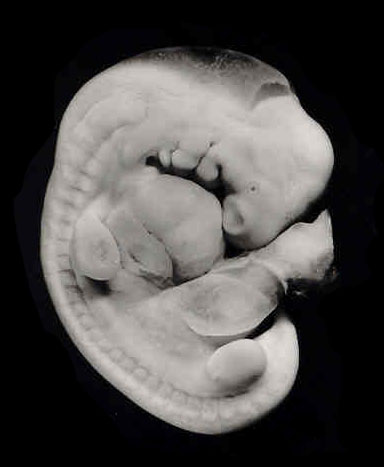 Right lateral view of the embryo prior to sectioning