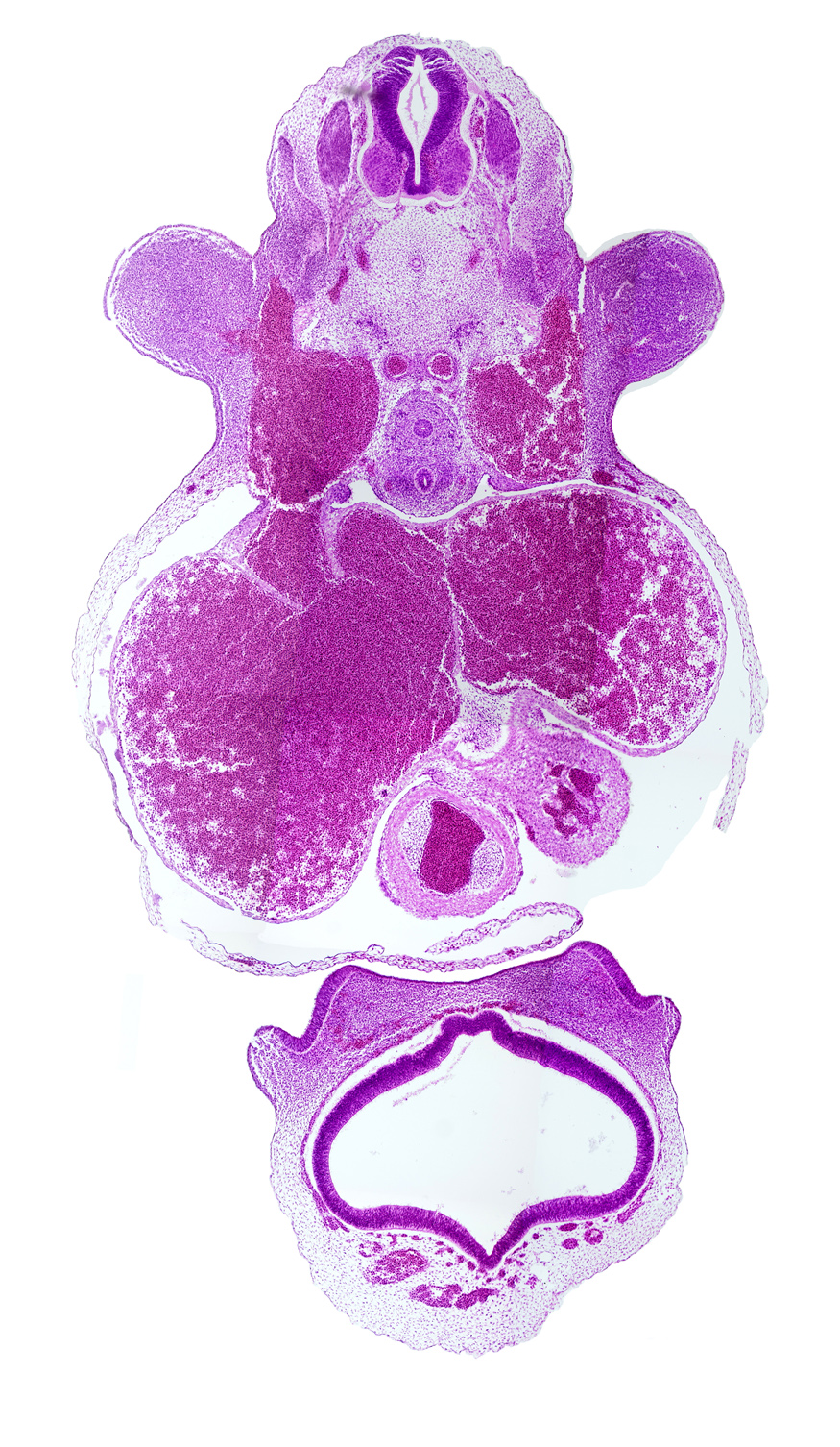 C-6 spinal ganglion, cerebral vesicle (telencephalon), dorsal aorta, esophagus, lateral ventricle, left atrium, left ventricle, nasal disc (olfactory placode), primary interatrial septum (septum primum), right atrium, sinus venosus, subclavian vein, third ventricle, trachea, truncus arteriosus (outflow tract), vascular plexus