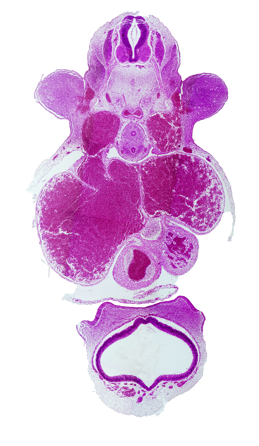 C-6 spinal ganglion, C-6 spinal nerve, central canal, cerebral vesicle (primordial cerebral hemisphere), dorsal aorta, esophagus, left atrium, left truncus ridge, left venous valve, left ventricle, marginal sinus, nasal disc (olfactory placode), neural arch blastema, notochord, pericardial cavity, primary interatrial septum (septum primum), right atrium, right common cardinal vein, right truncus ridge, right venous valve, sinus venosus, telencephalon medium, trachea, truncus arteriosus (outflow tract), upper limb