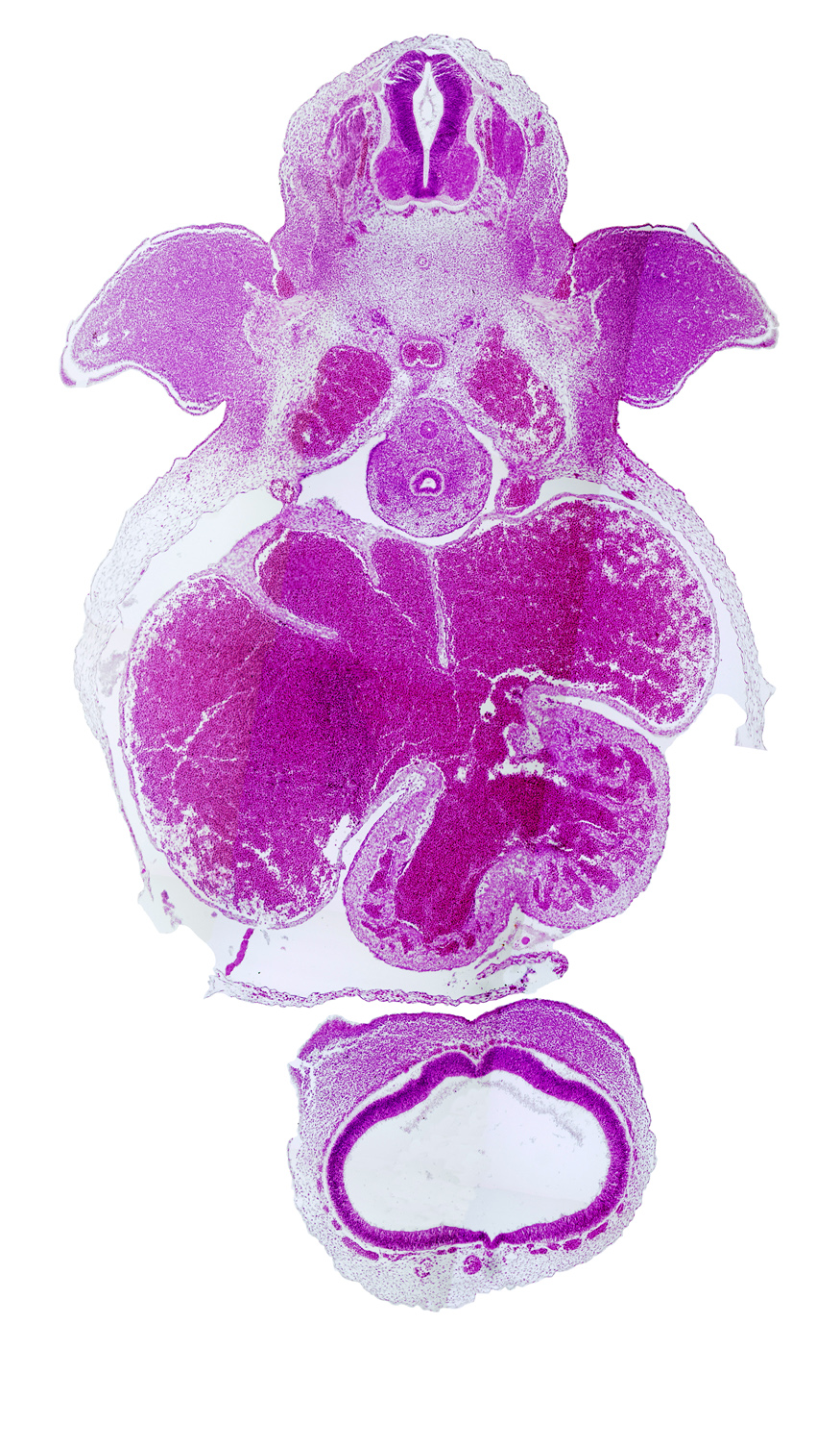 C-7 spinal ganglion, aorta, apical epidermal ridge, cerebral vesicle (primordial cerebral hemisphere), esophagus, frontonasal prominence, interventricular groove, lateral ventricle, left atrium, left common cardinal vein, left venous valve, left ventricle, musculi pectinati, notochord, postcardinal vein, primary interatrial foramen (foramen primum), primary interatrial septum (septum primum), right atrium, right venous valve, right ventricle, sinus venosus, telencephalon medium, trachea, upper limb