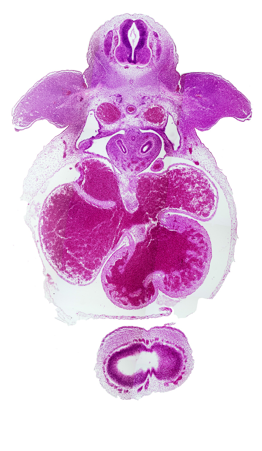 C-7 spinal ganglion, aorta, atrioventricular endocardial cushion(s), cerebral vesicle (telencephalon), frontonasal prominence, interventricular groove, lamina terminalis, lateral ventricle, left atrioventricular canal, left common cardinal vein, left upper secondary bronchus bud, left ventricle, lower edge of right venous valve, mesocardium, pericardioperitoneal canal (pleural cavity), postcardinal vein, primary interatrial foramen (foramen primum), pulmogenic coat, right atrioventricular canal, right atrium, right ventricle, sinus venosus