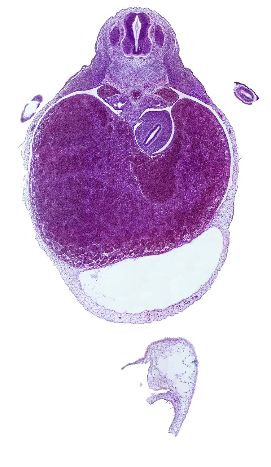 T-2 spinal ganglion, aorta, caudal end of upper limb, dorsal mesogastrium, ductus venosus, left hepatic vein, liver, myotome, notochord, pericardial cavity, pericardial sac, peritoneal cavity, septum transversum, stomach