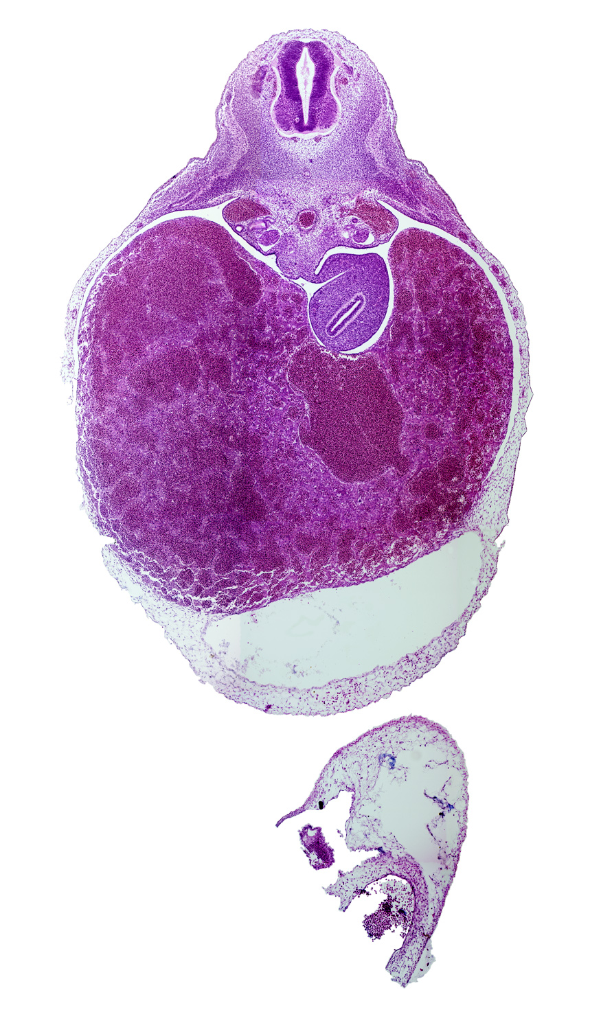 T-2 / T-3 interganglion region, central canal, dorsal mesogastrium, ductus venosus, falciform ligament, liver, mesonephric duct, mesonephros, myotome, neural arch blastema, pericardial cavity, postcardinal vein, rib blastema, septum transversum, stomach, vertebral centrum blastema