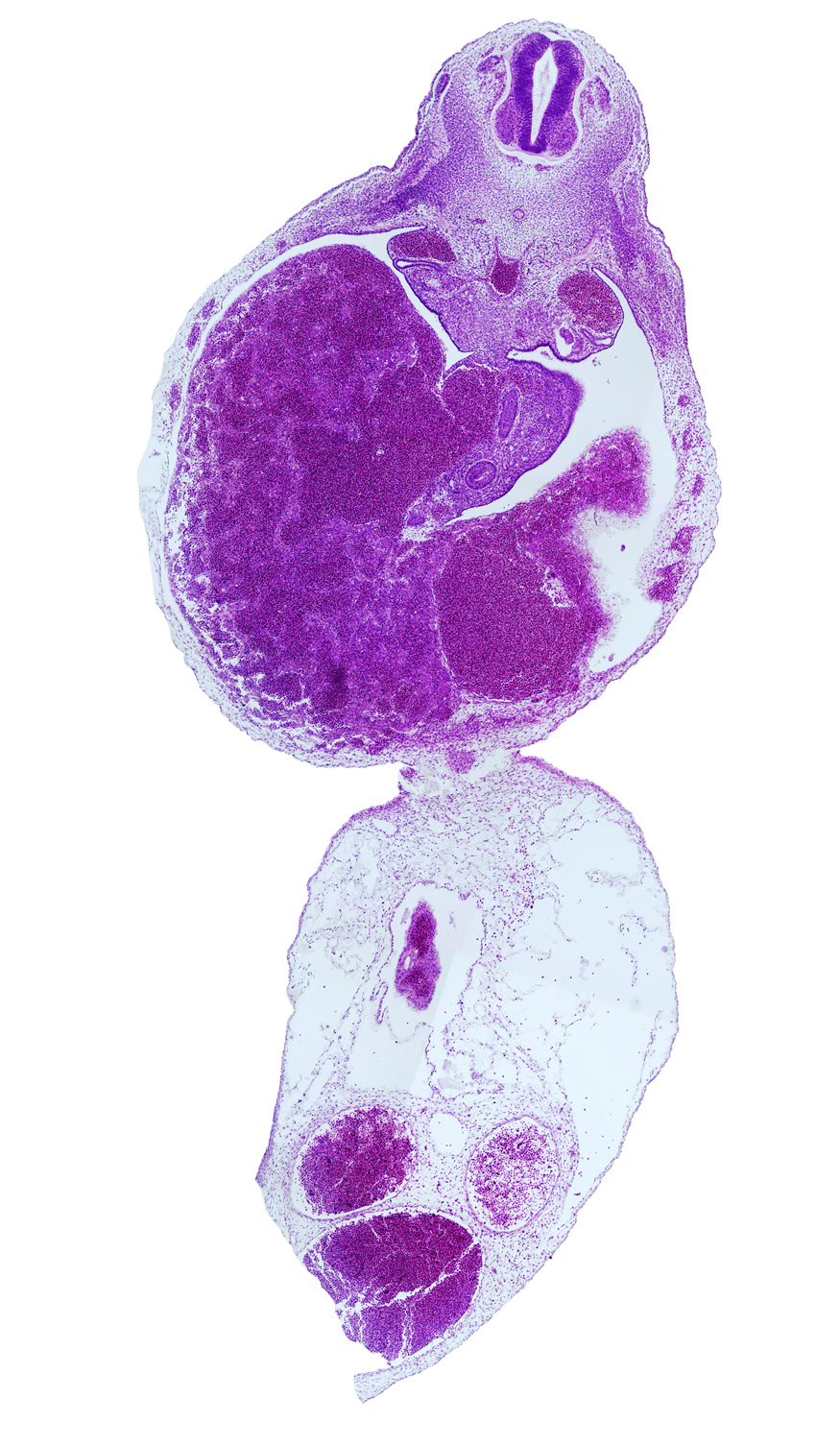 allantois, dorsal pancreatic bud, ductus venosus, duodenum, epaxial part of myotome, hypaxial part of myotome, left umbilical artery, liver, mesonephric duct, neural arch blastema, postcardinal vein, rib blastema, right umbilical artery, subcardinal vein, umbilical coelom, umbilical vein, umbilical vesicle stalk remnant