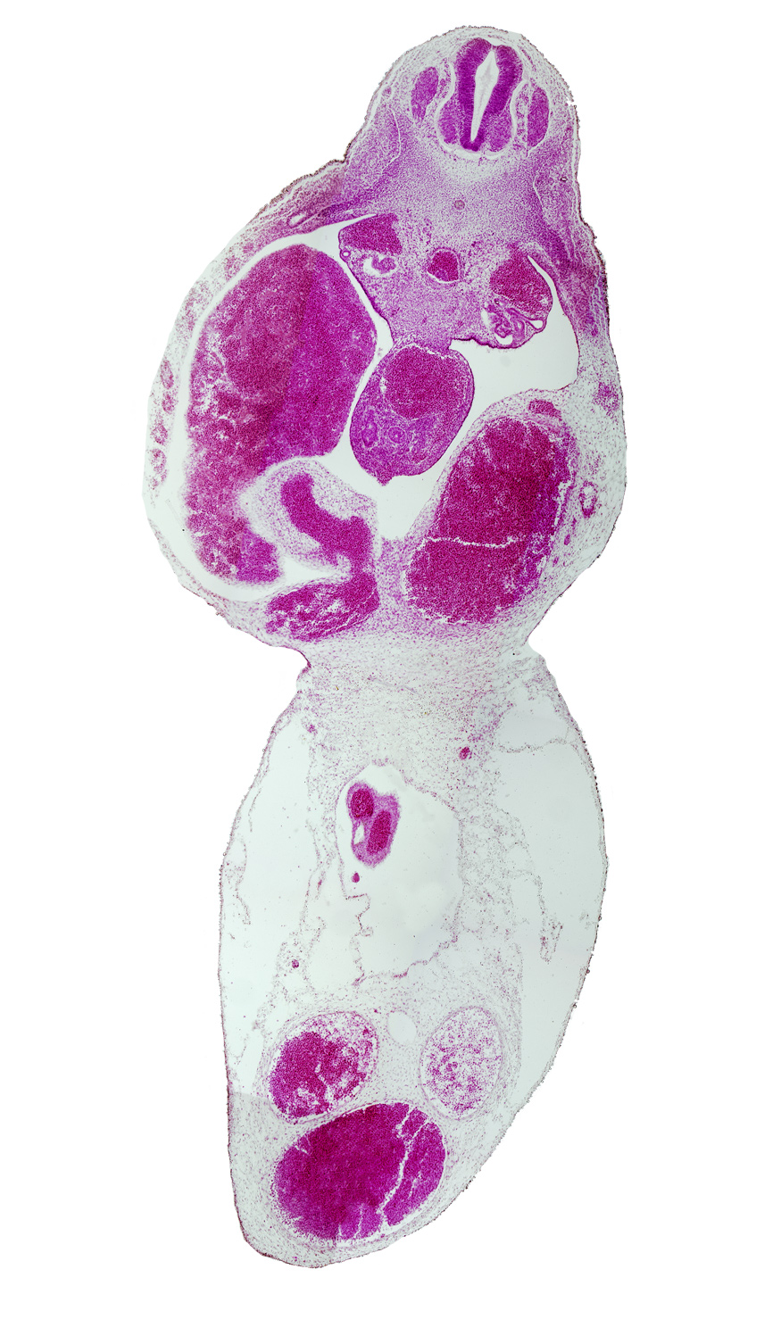 T-5 spinal ganglion, aorta, left umbilical artery, left umbilical vein (congested), liver, mesonephric duct, postcardinal vein, right umbilical artery, right umbilical vein, umbilical coelom, umbilical cord, umbilical vein, vitelline (omphalomesenteric) vein