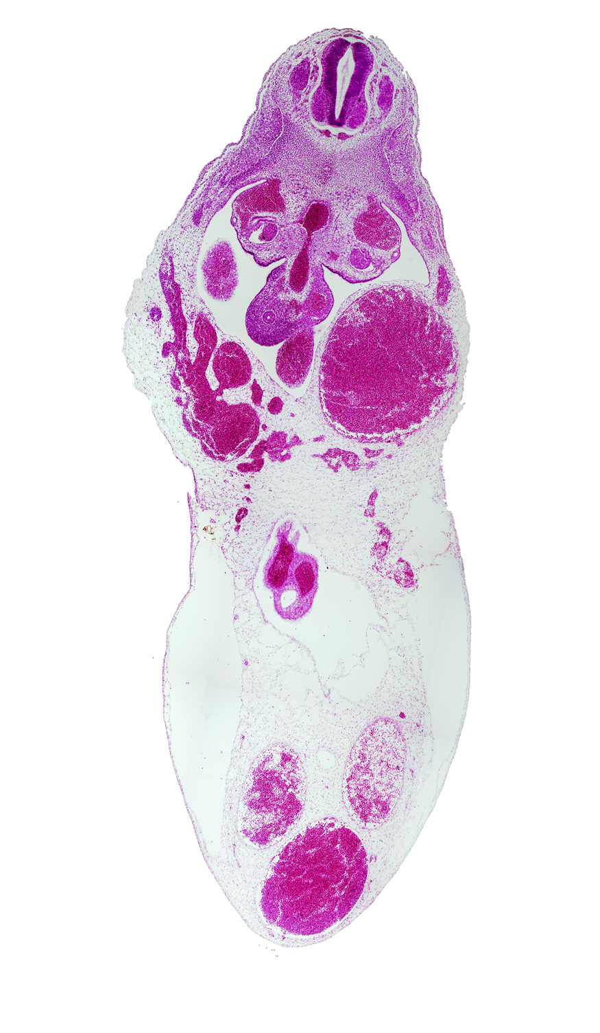 T-6 spinal ganglion, aorta, caudal edge of liver, cephalic part of gonadal ridge, left umbilical artery, midgut, notochord, peritoneal cavity, right umbilical artery, superior mesenteric artery, umbilical vein, umbilical vesicle stalk remnant, vitelline (omphalomesenteric) artery, vitelline (omphalomesenteric) vein