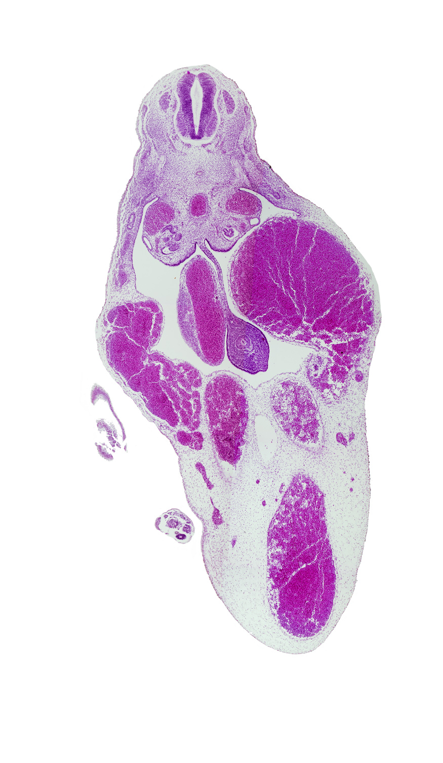 T-8 spinal ganglion, caudal eminence, dorsal mesentery, foot plate, left umbilical artery, left umbilical vein, midgut, right umbilical artery, right umbilical vein, superior mesenteric artery, umbilical cord, umbilical vein
